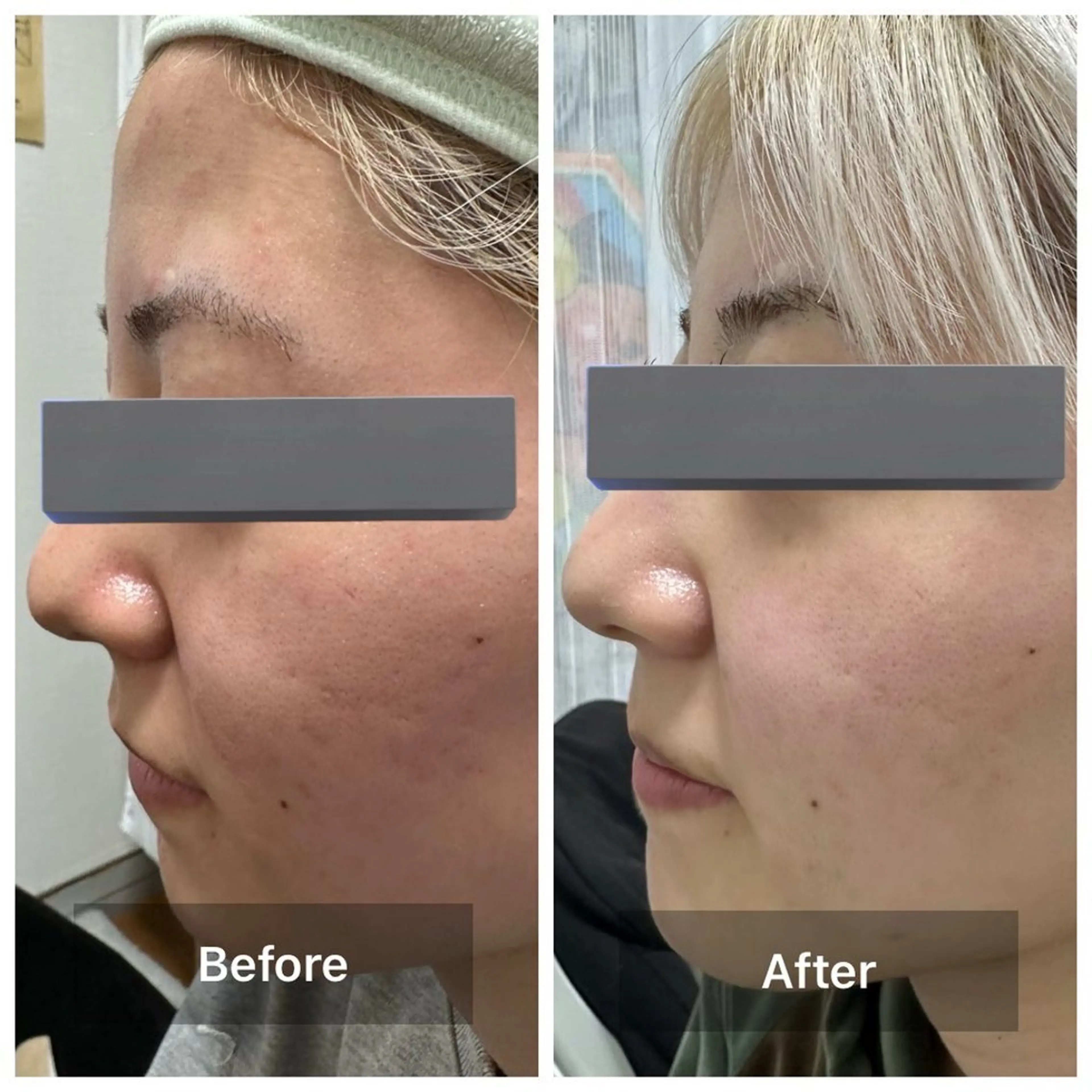 エステ 上原 巴のエステ・リラクイメージ