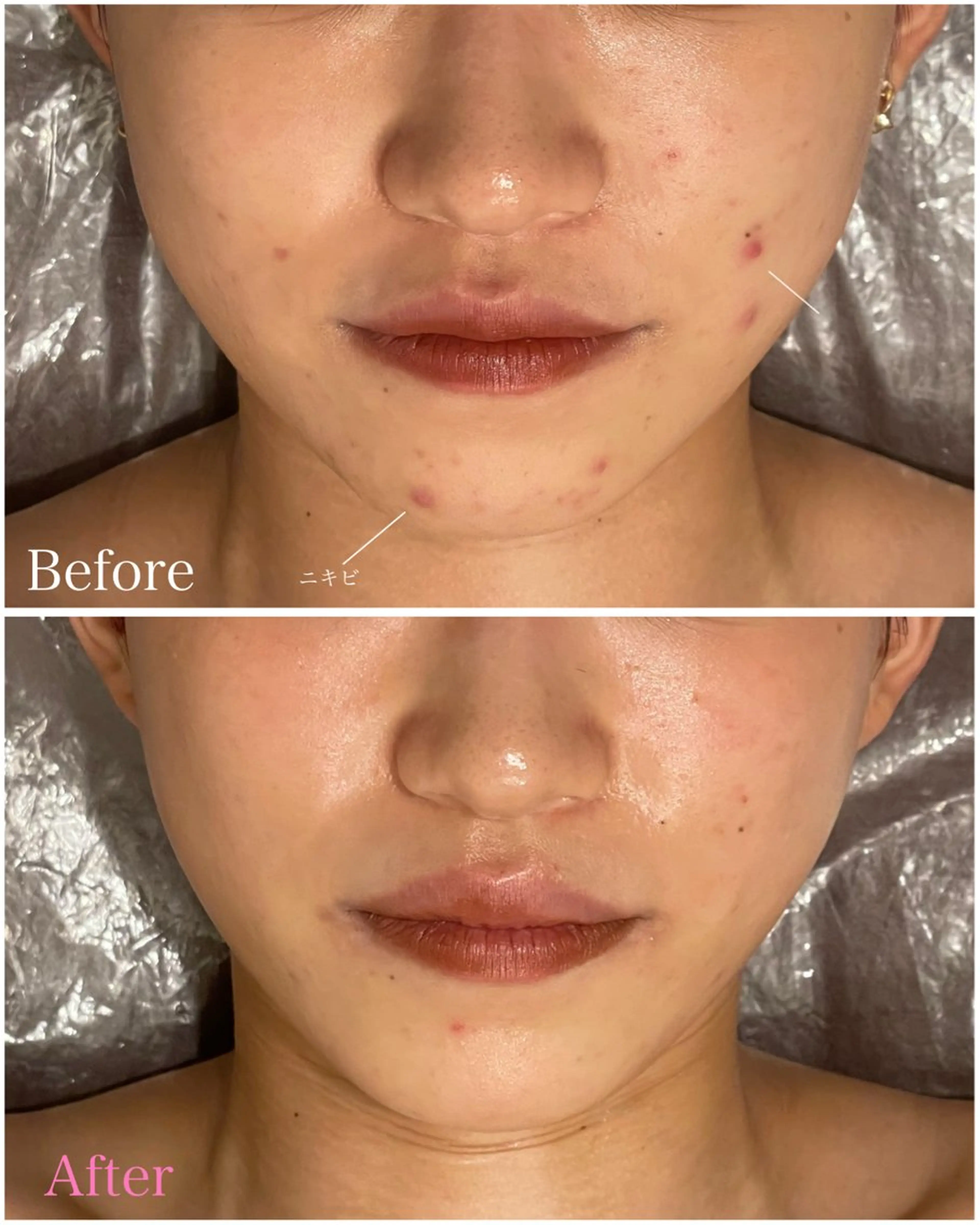 中尾 朱里のエステ・リラクイメージ