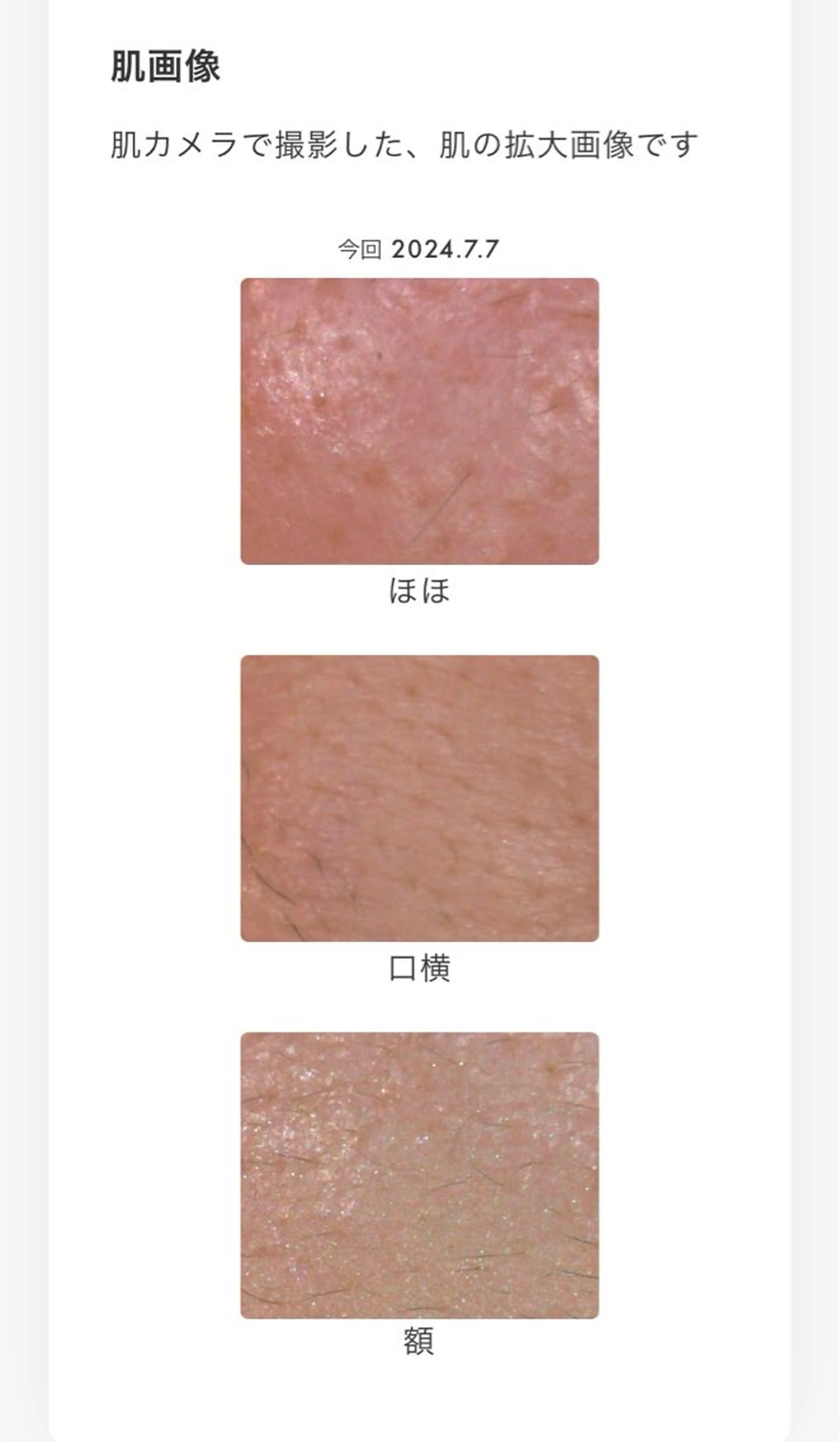 POLA御器所店 かわいれなのエステ・リラクイメージ