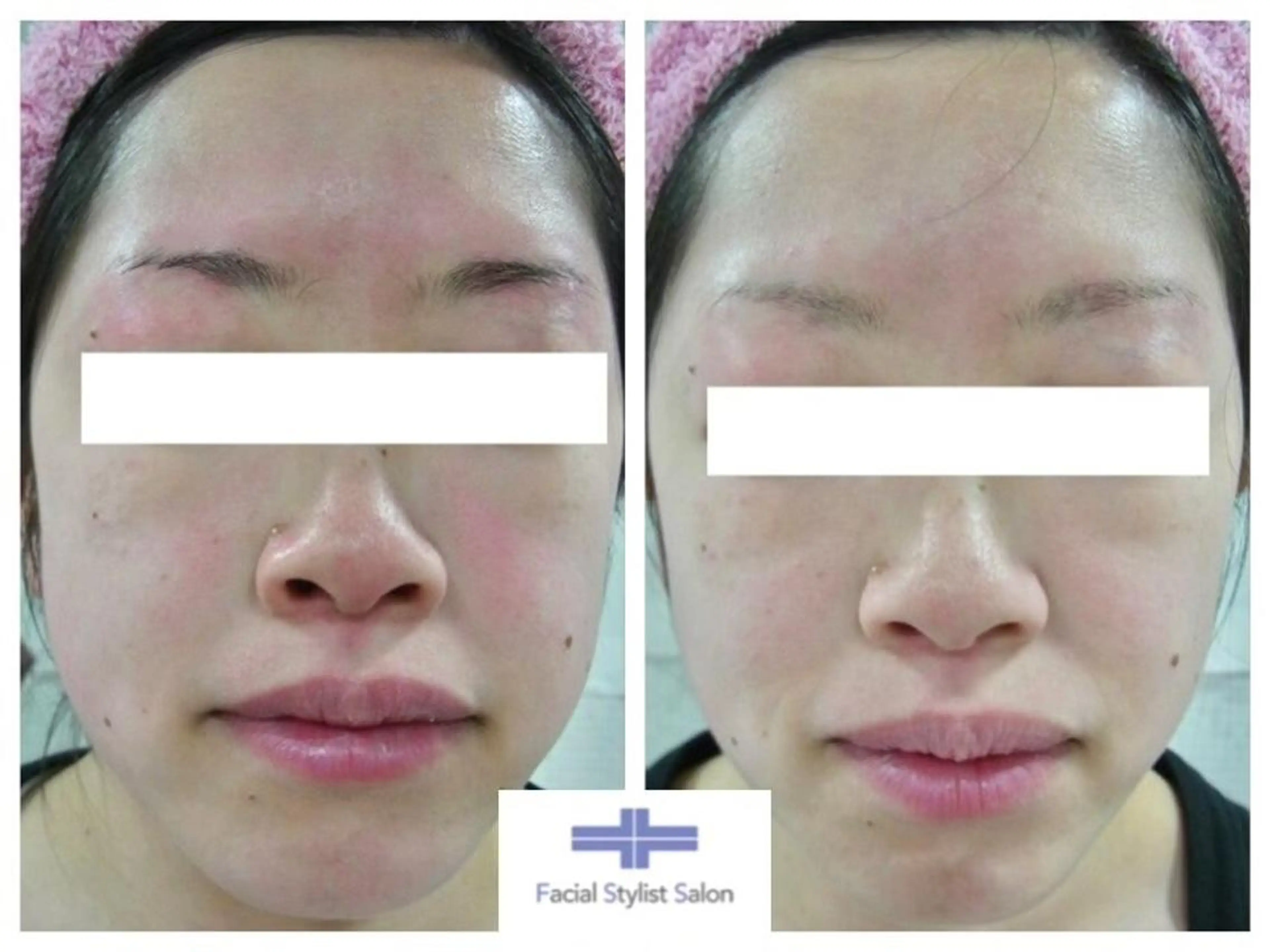 肌質改善専門サロン ／FSS渋谷店　松本のエステ・リラクイメージ