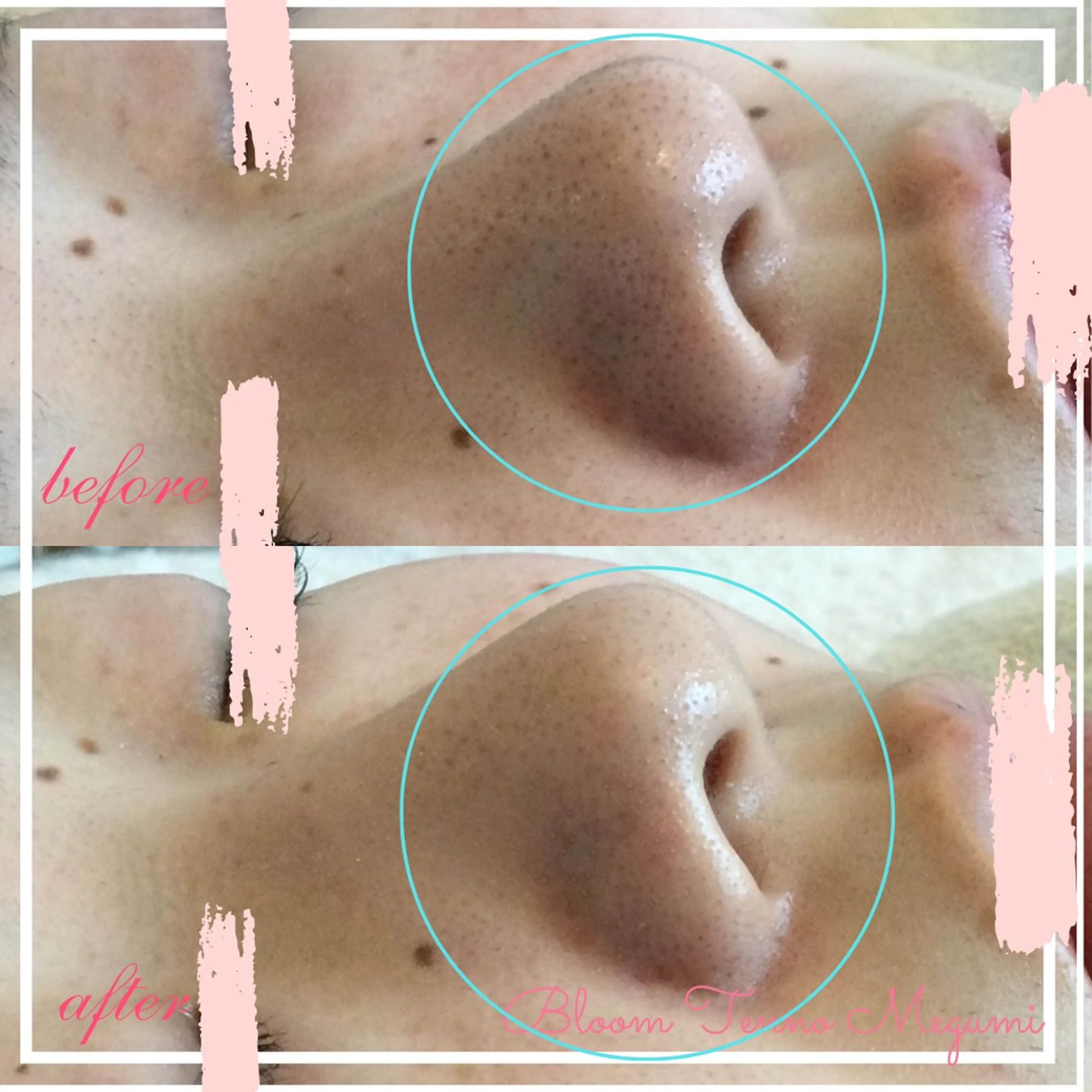 BLOOM〜 天恵（てんのめぐみ）のエステ・リラクイメージ