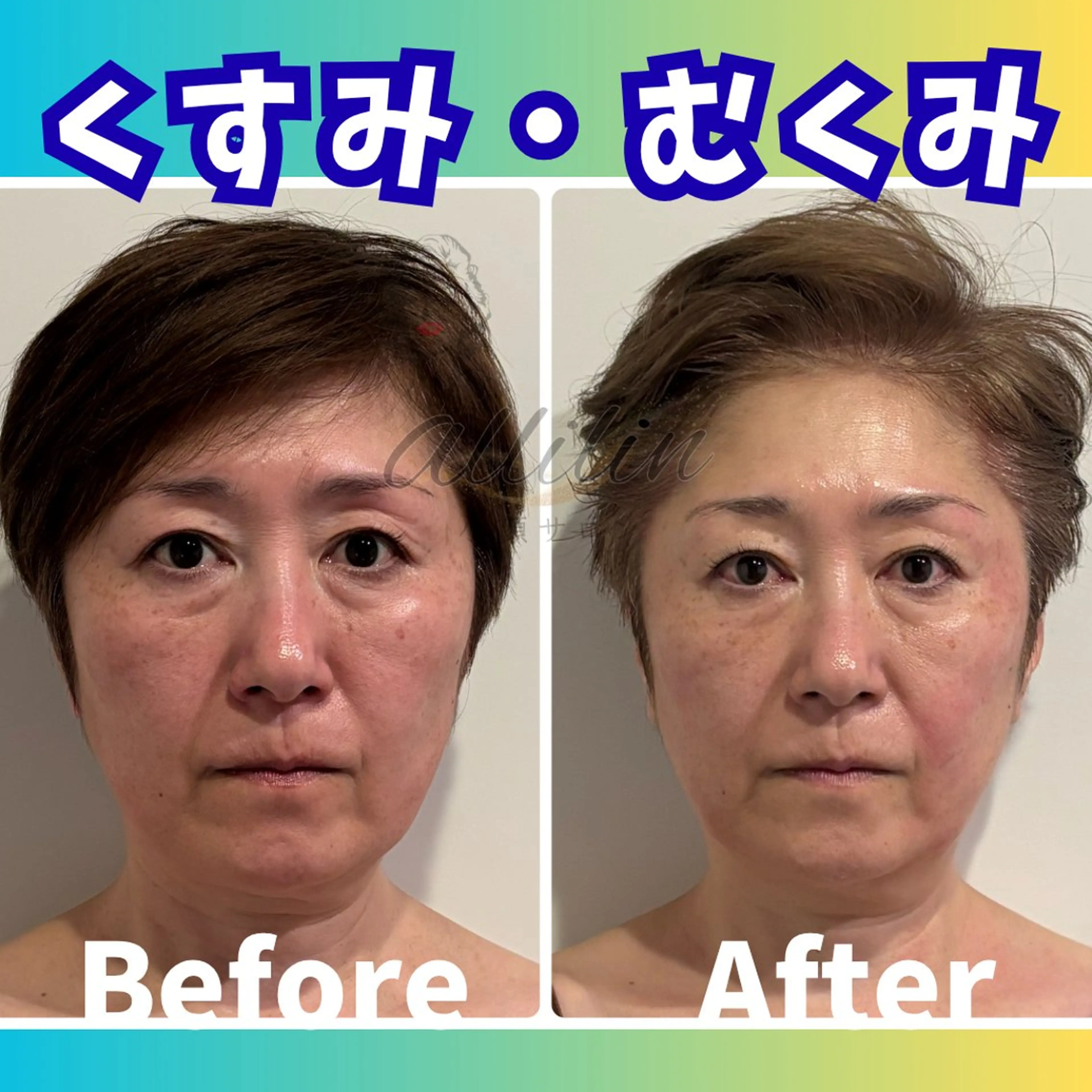 💎小顔ｻﾛﾝ アリリン銀座💎のエステ・リラクイメージ