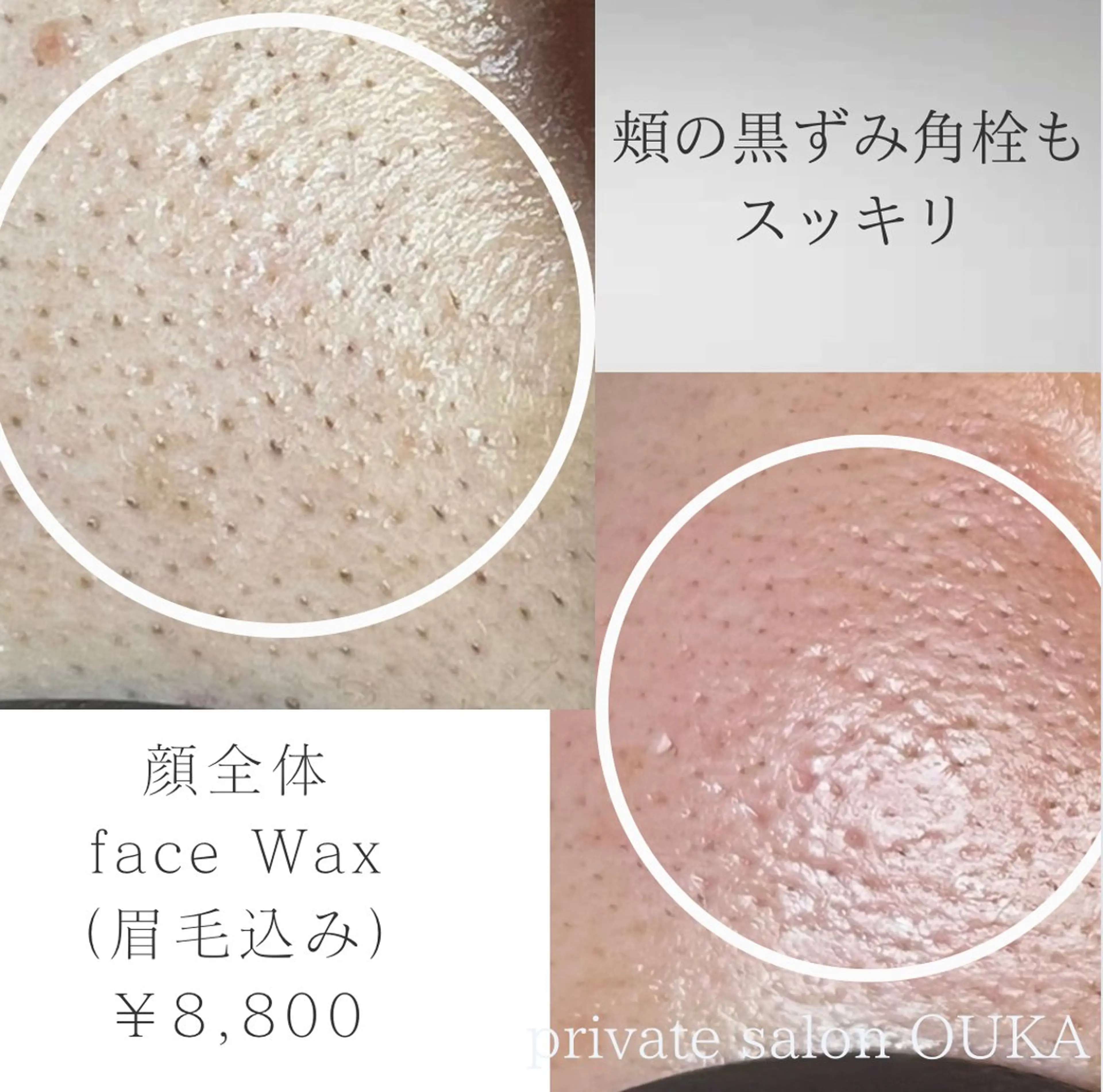 アイブロウ 眉毛ワックス脱毛 OUKA脱毛 毛穴ケアフェイシャルのエステ・リラクイメージ