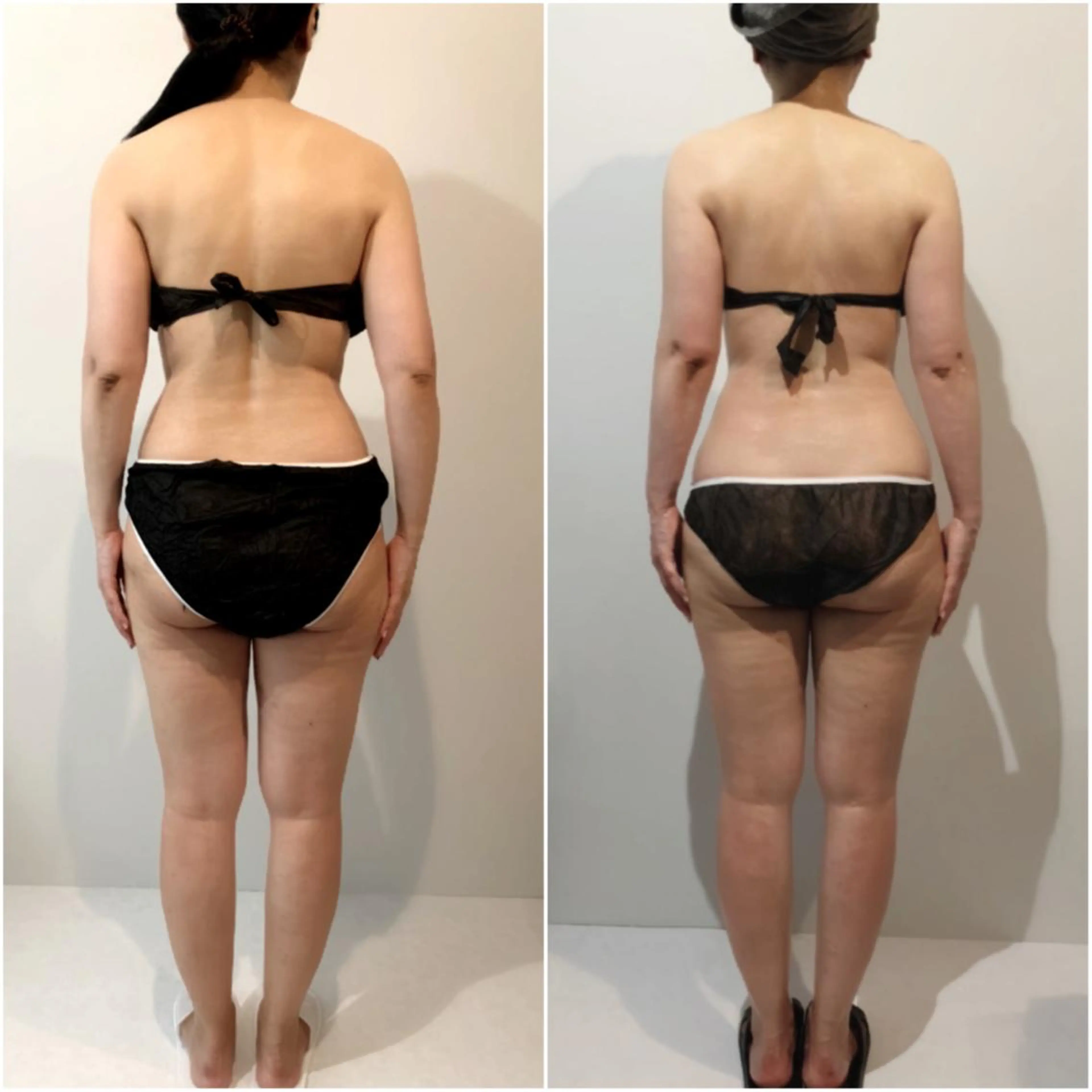 エステ リラク ボディメンテナンス shinomaのエステ・リラクイメージ