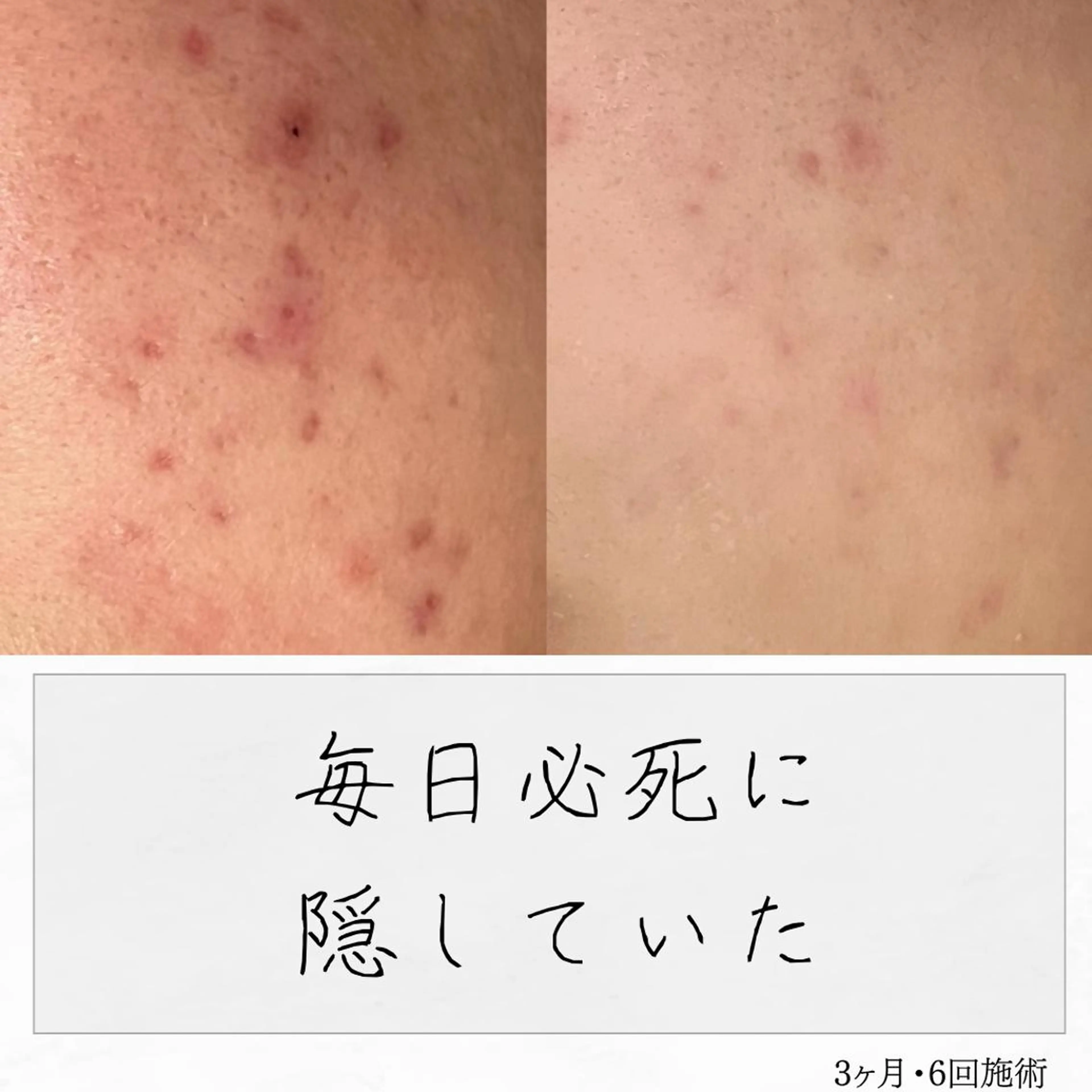 ニキビ経験者が施術 する専門サロン🌻のエステ・リラクイメージ