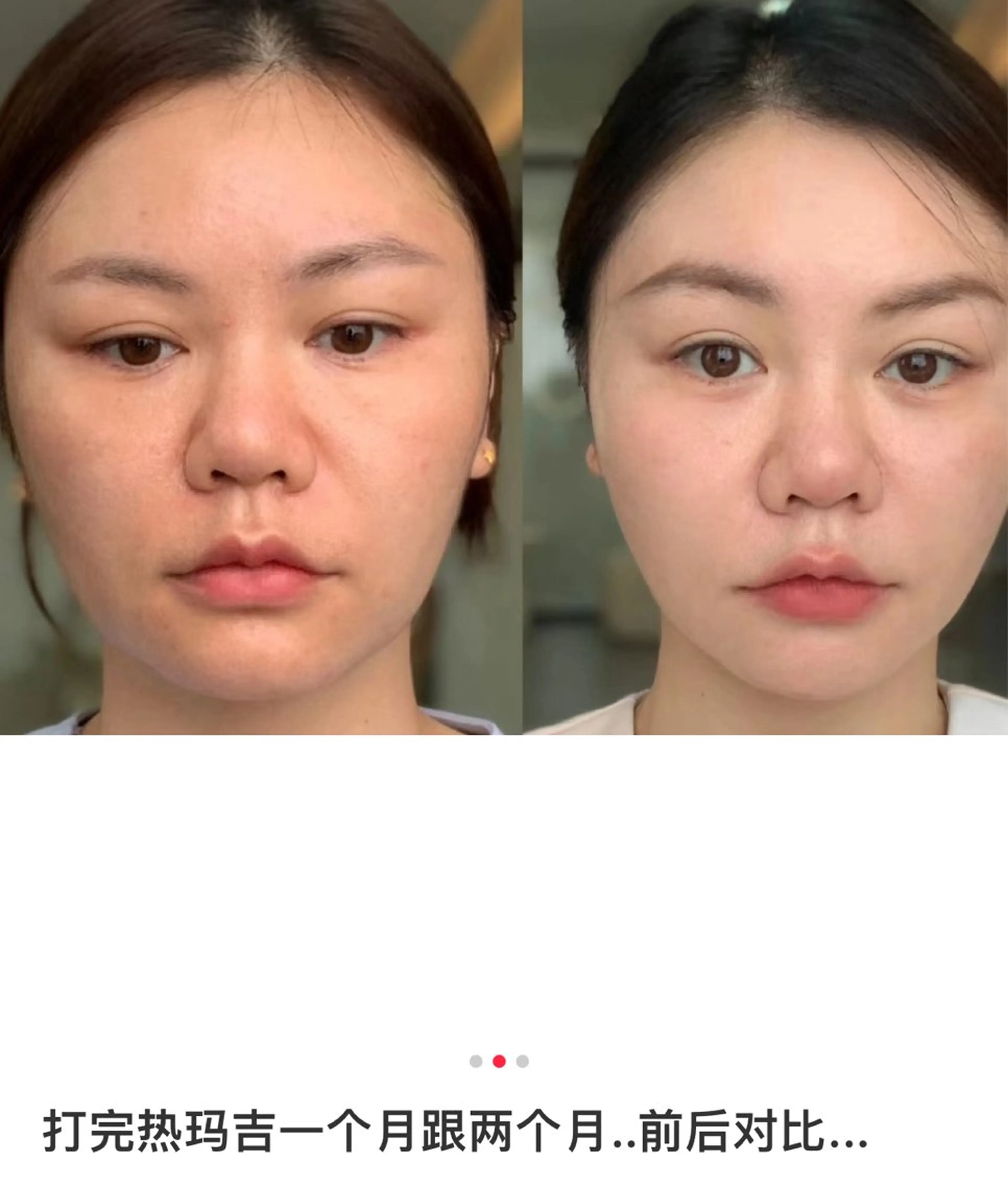 マツエク・マツパ エステ aliaハイフ&水光ジェットサロン所属・aliaハーブ水光店 エステティシャン募集のエステ・リラクイメージ