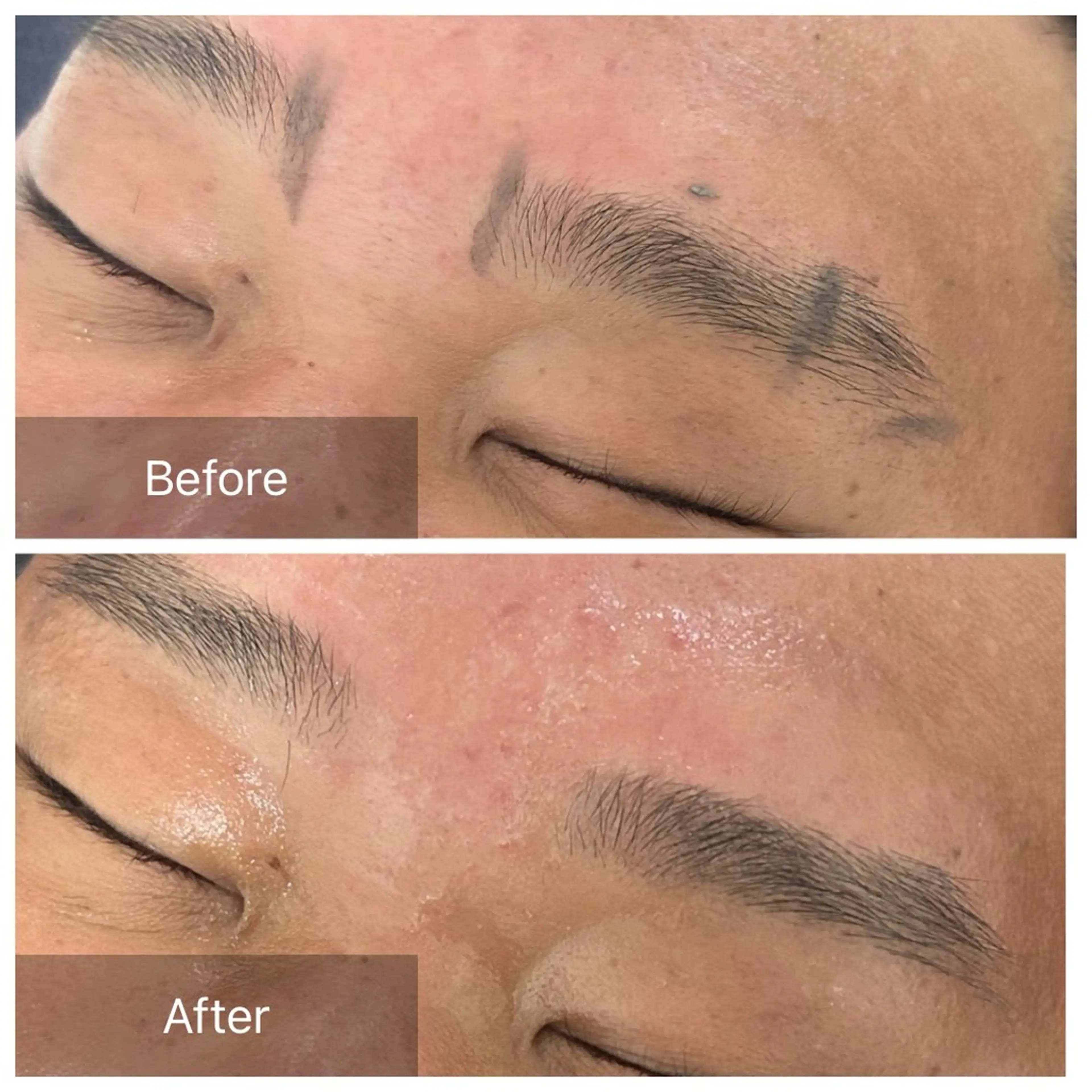 メンズ アイブロウ ワックス脱毛 エマニエル USAのエステ・リラクイメージ