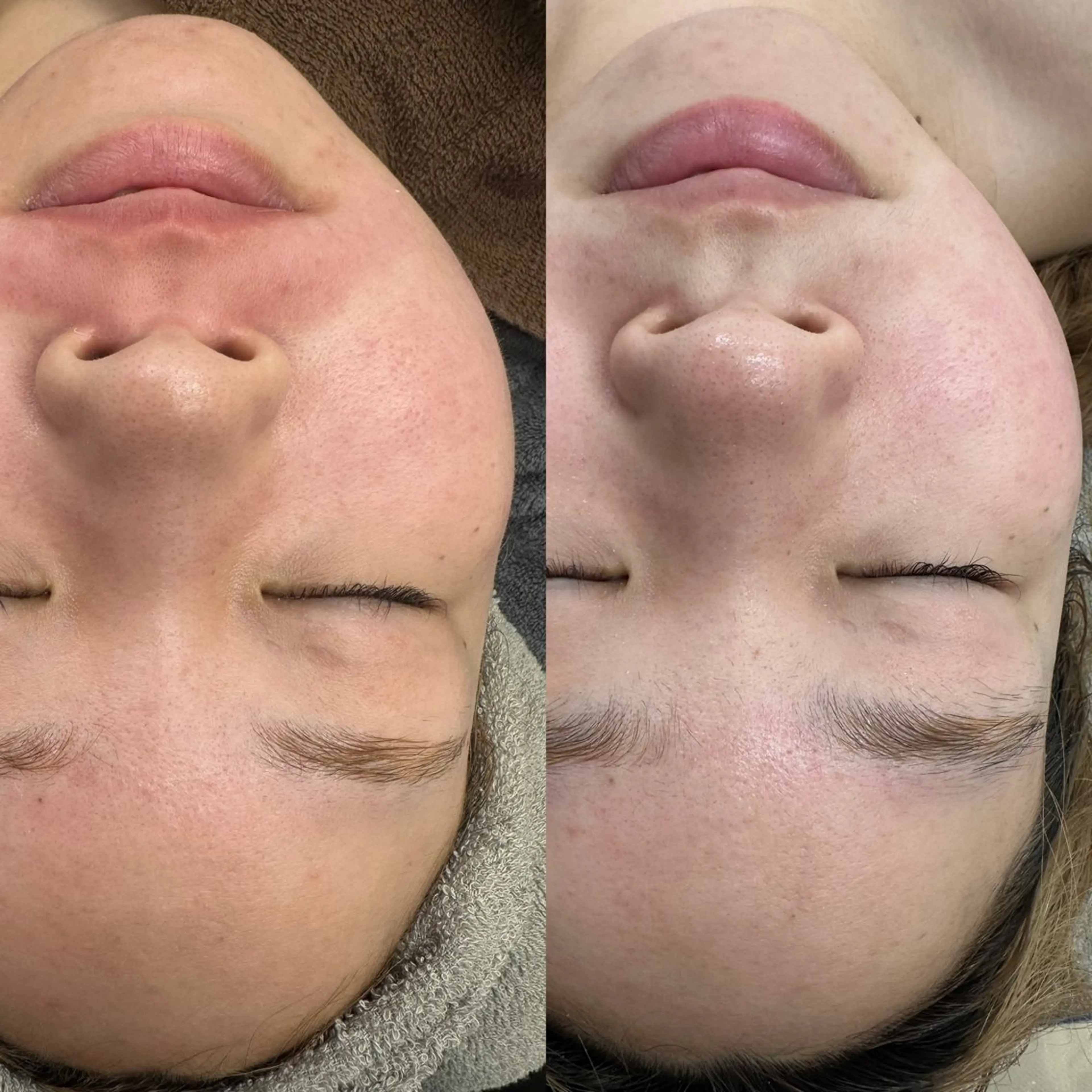 エステ ハーブピーリング /KAEDEのエステ・リラクイメージ