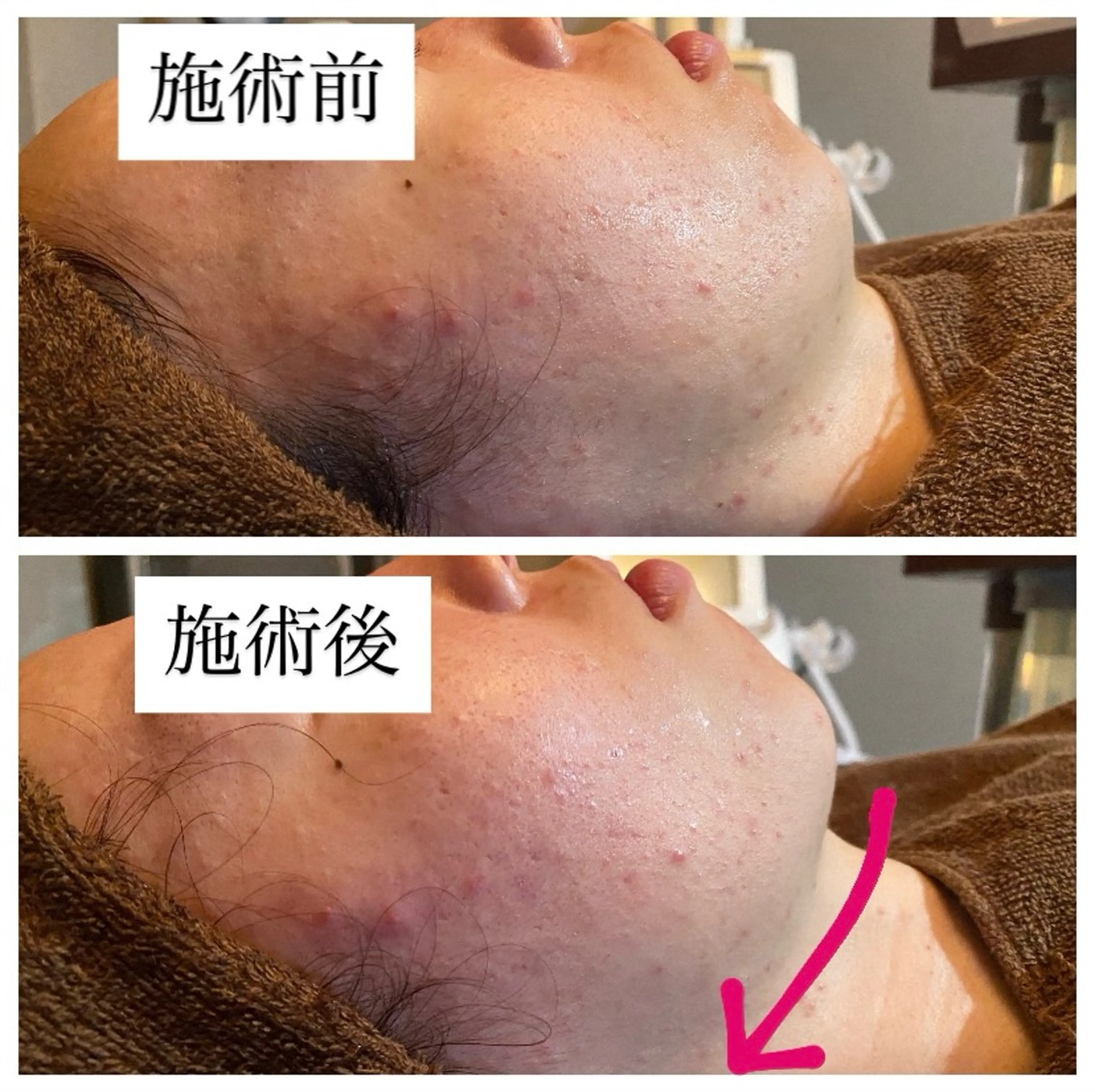 エステ 肌質改善専門 ハーブ /毛穴洗浄 リエイトのエステ・リラクイメージ