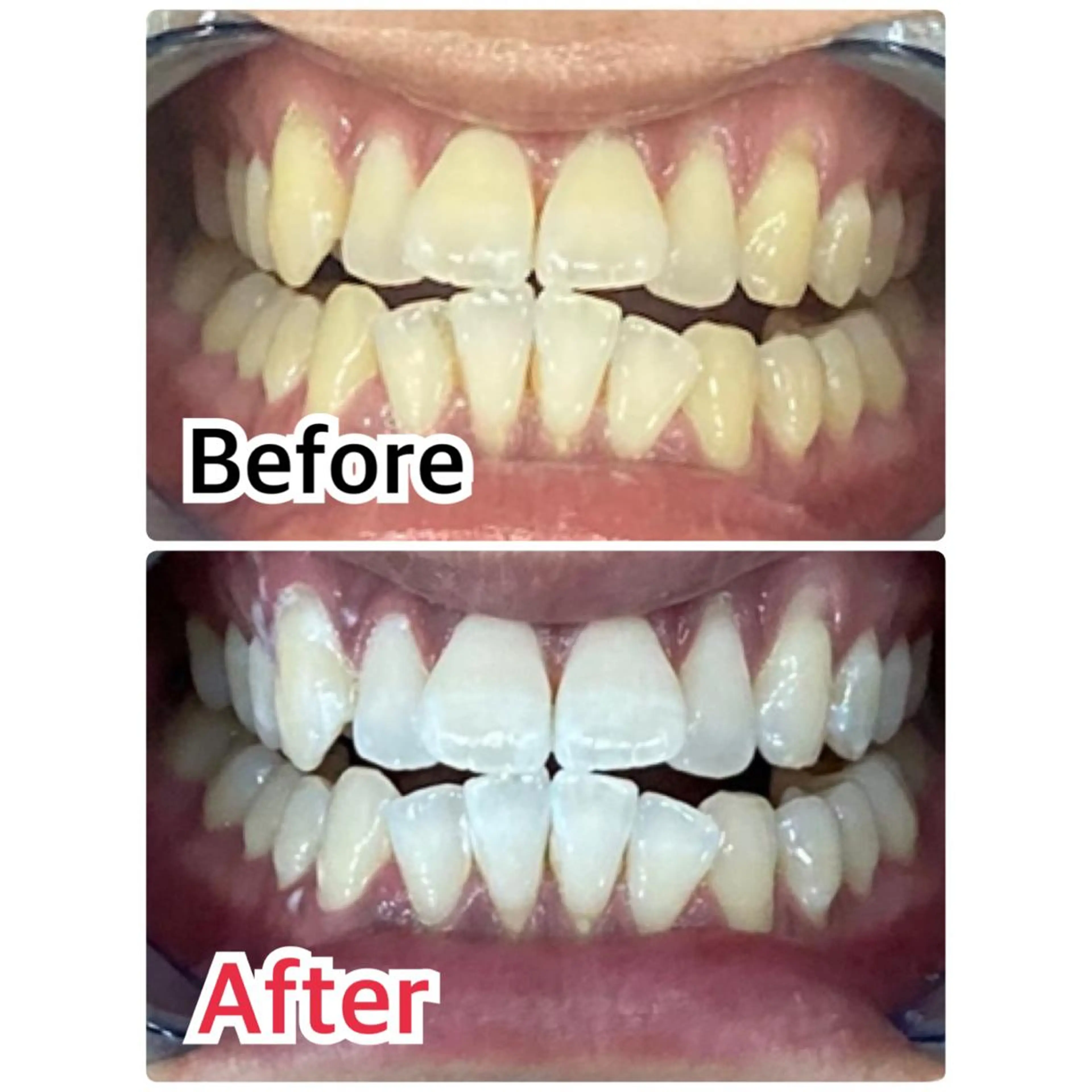 【歯科提携】柏ホワイ トニングスタイルのその他イメージ