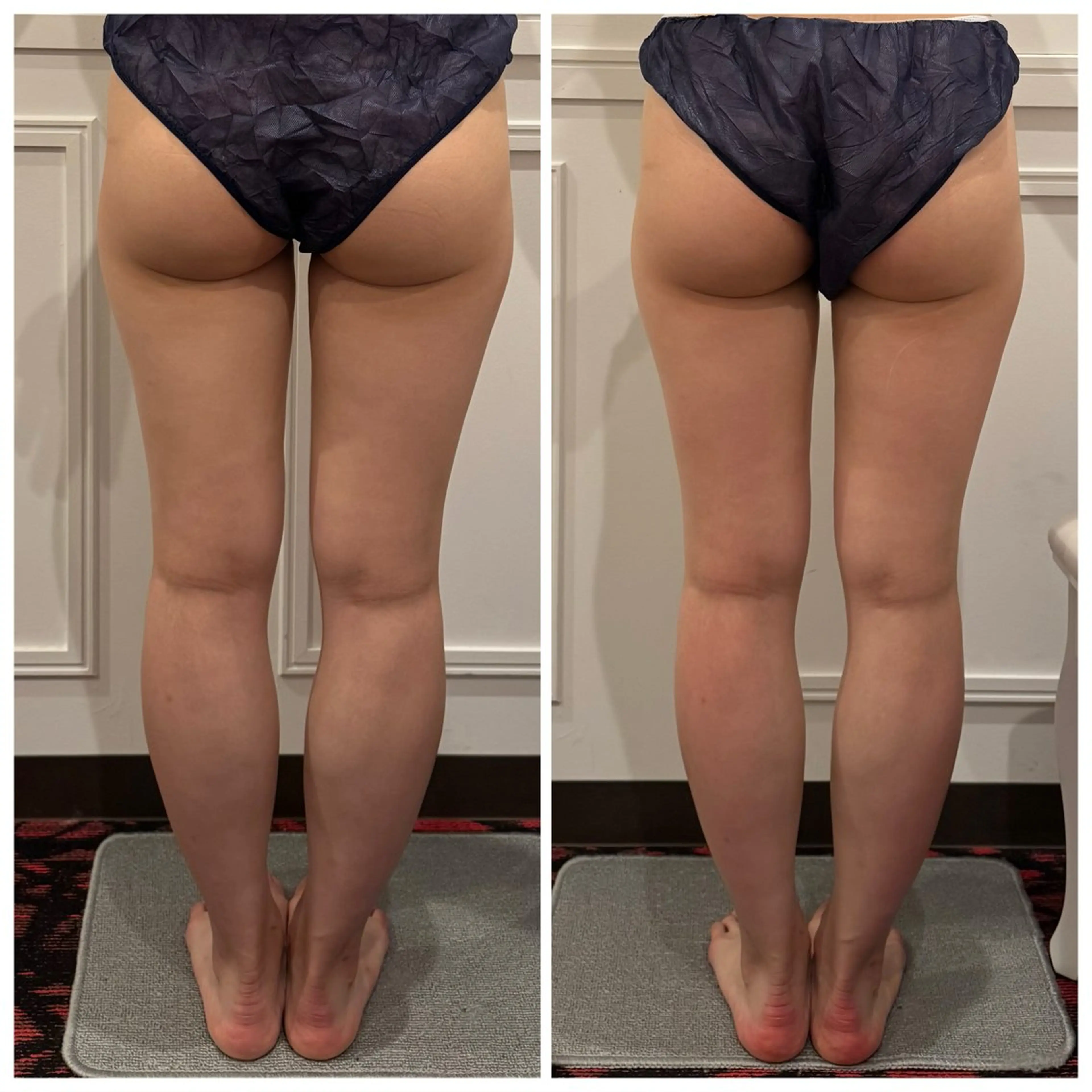 エステ リラク 小顔EX心斎橋 REVIハーブのエステ・リラクイメージ