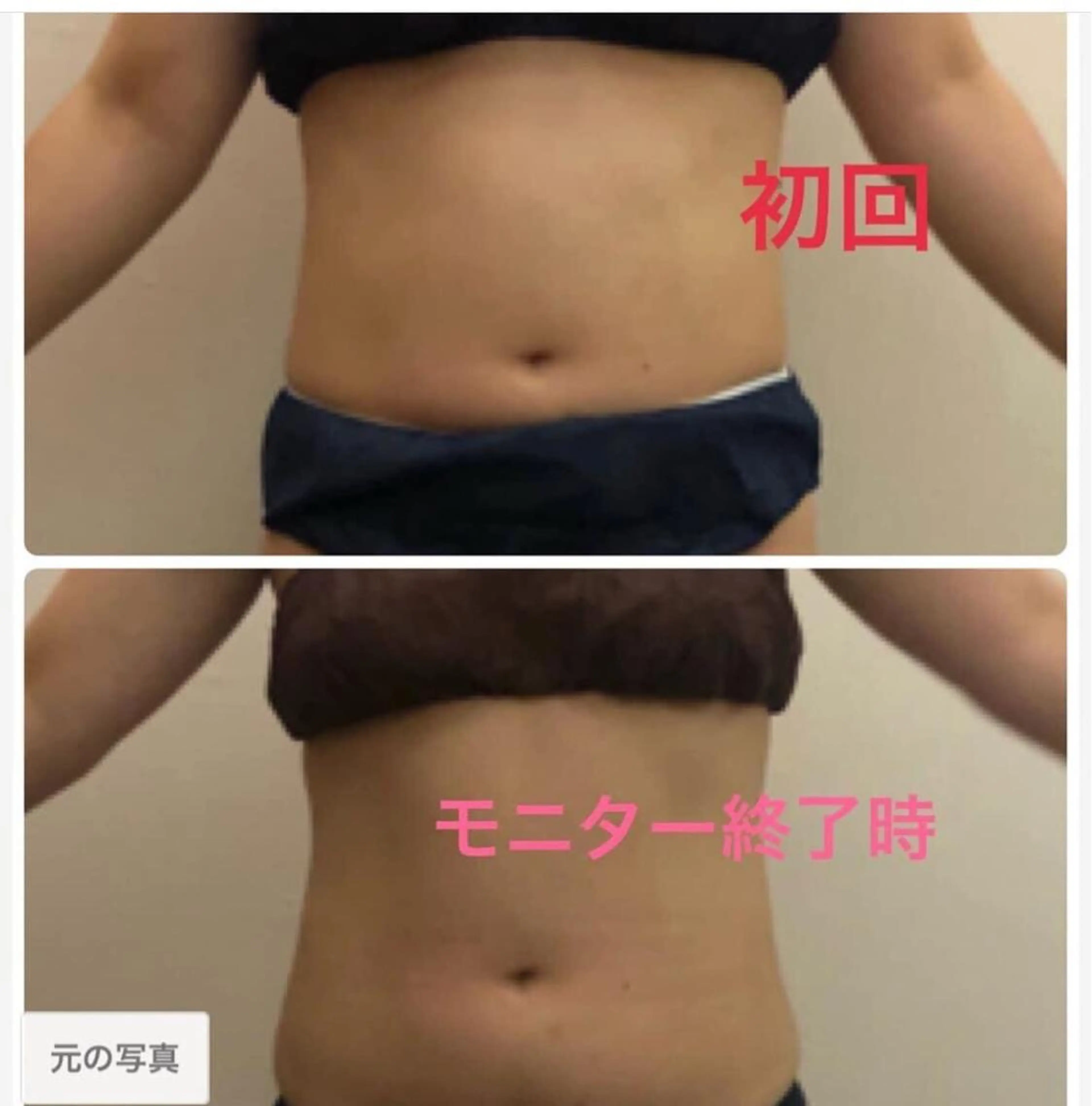 ミラクルウェーブ（おなか周り）＋コラーゲンマシン40分の写真