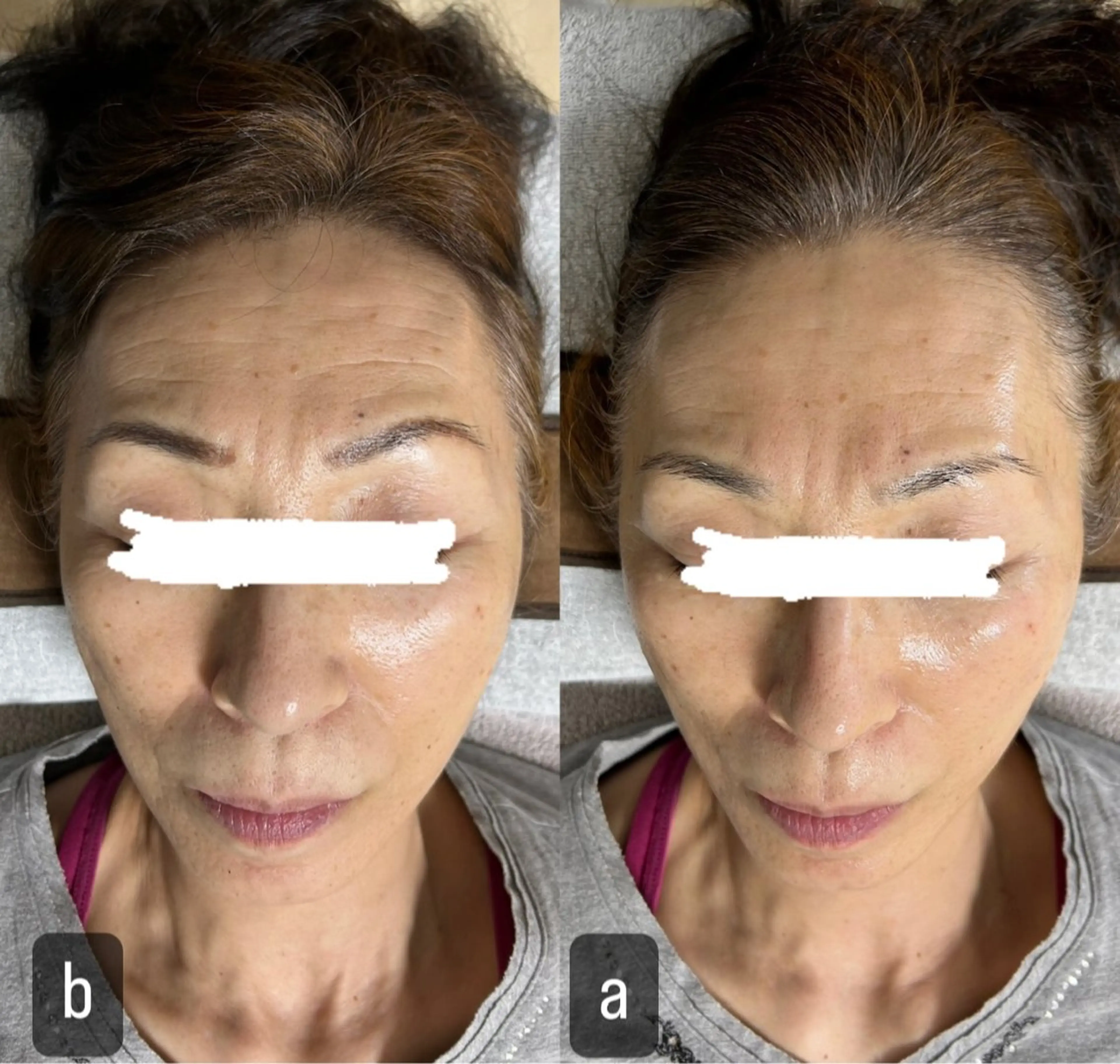 217 ホワイトニングルームのエステ・リラクイメージ