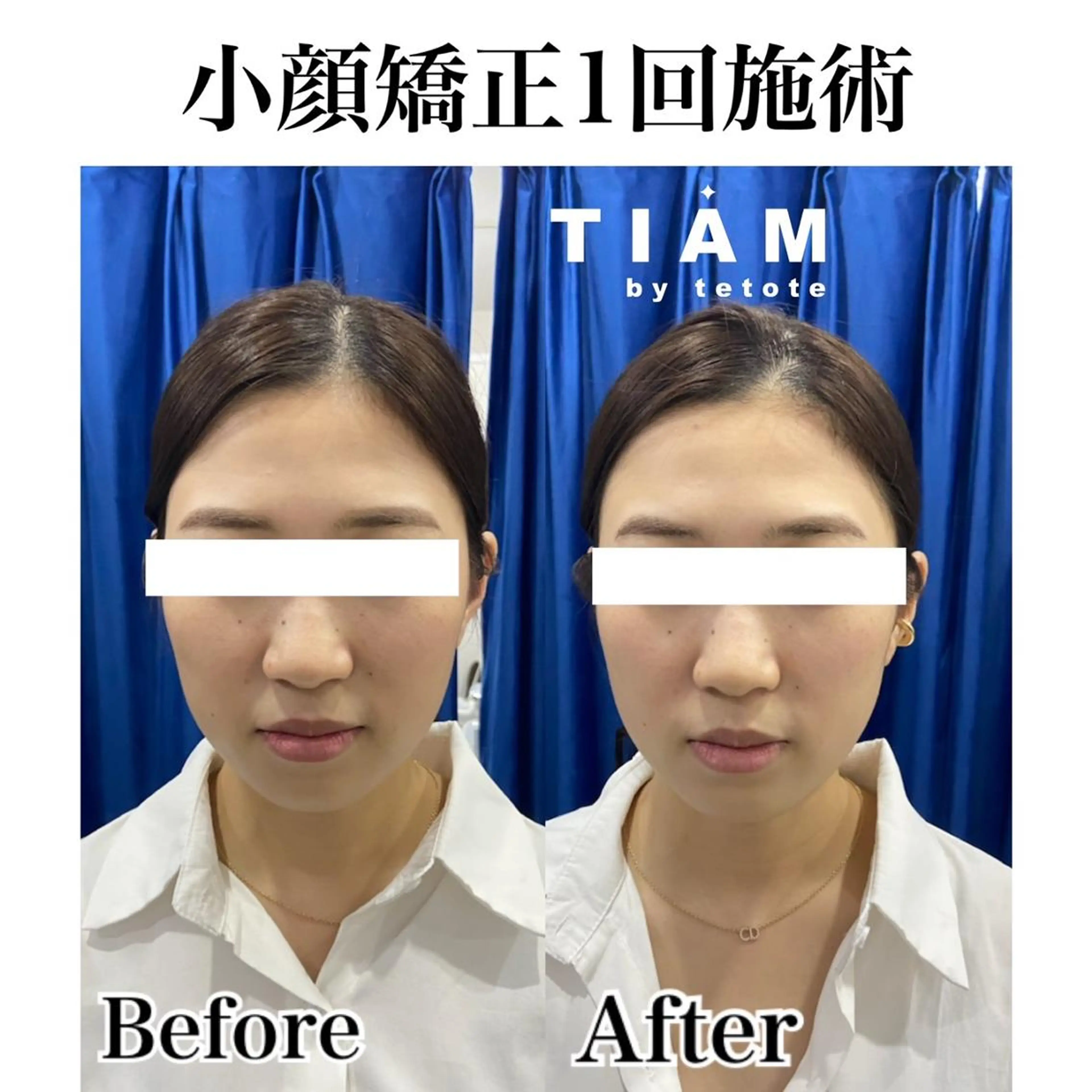 美肌サロンTIAM by tetoteのエステ・リラクイメージ