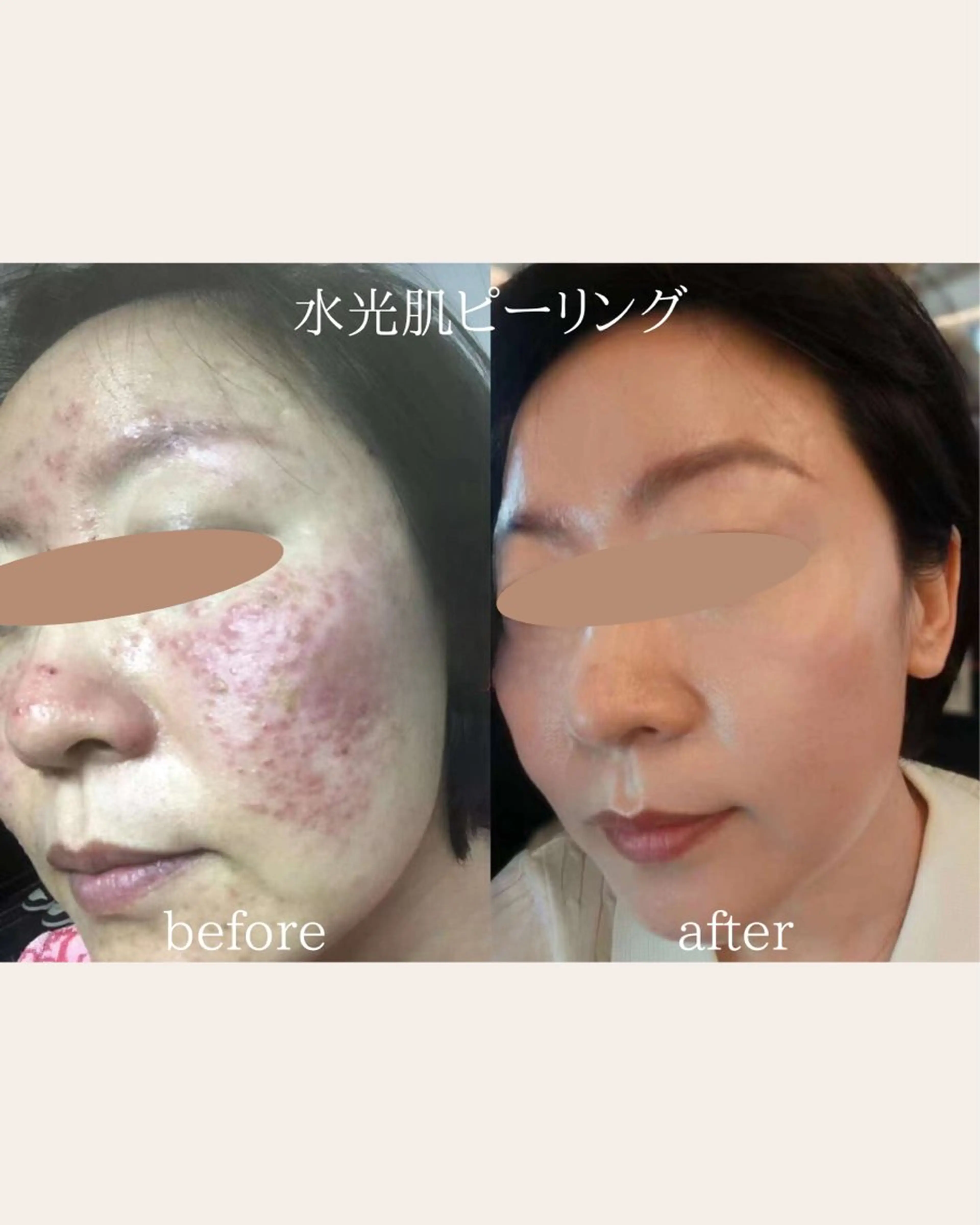 美腸サロン🌺 腸もみ/小顔/リンパのエステ・リラクイメージ