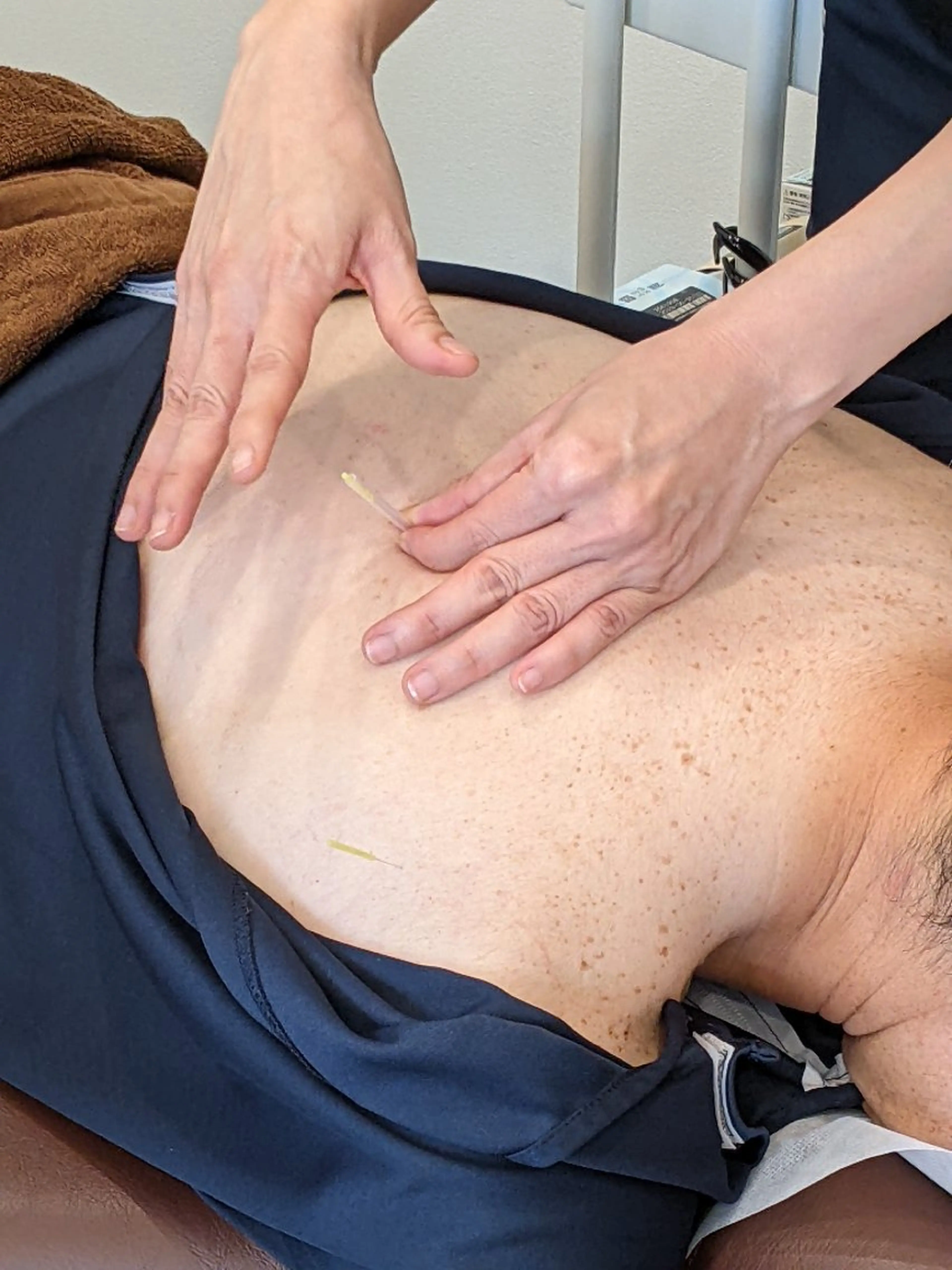 ✨️要望に応えます✨️整体と鍼の贅沢体験を０円キャンペーン!!5月29日まで✨️の写真