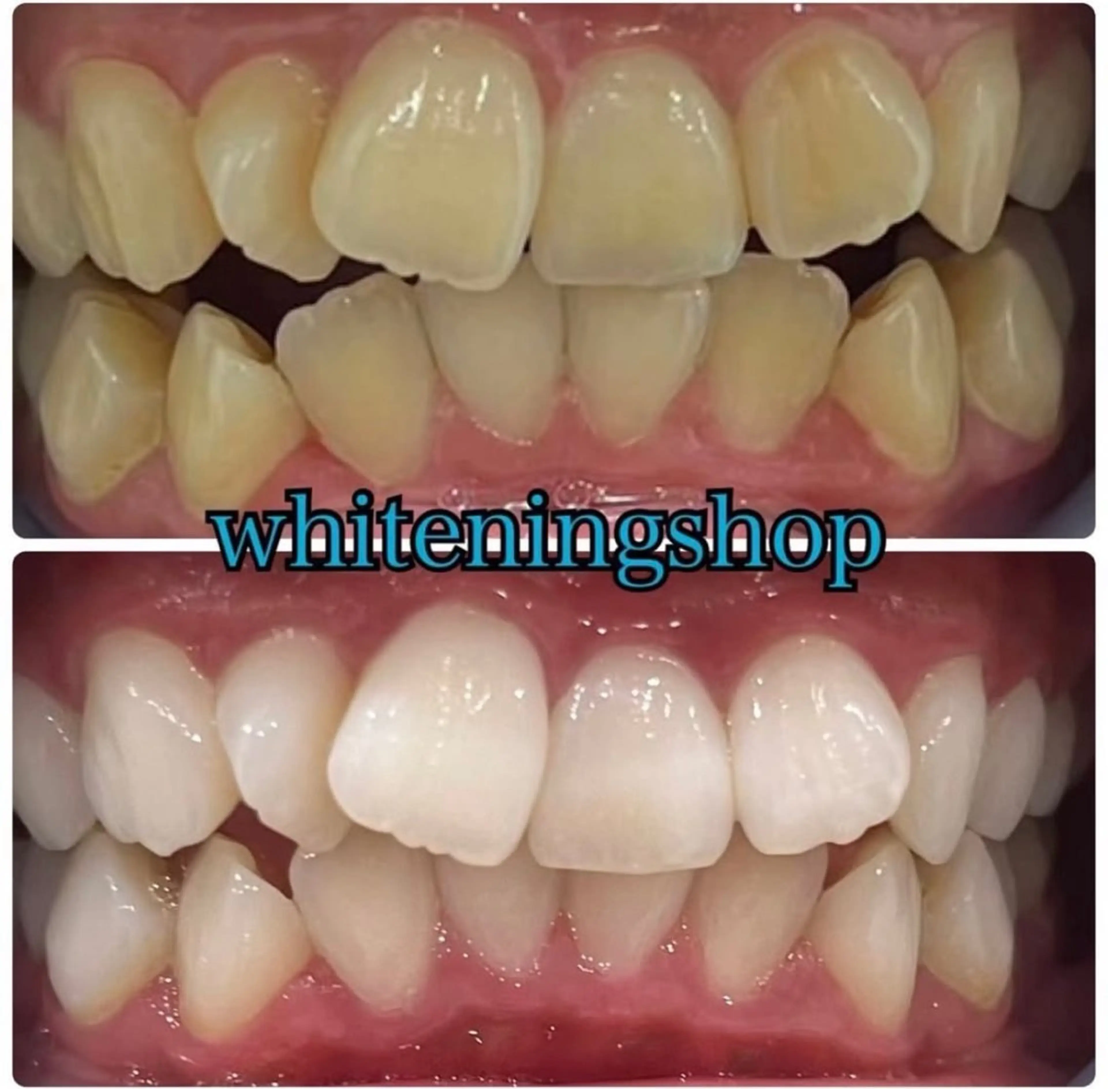 ホワイトニング ショップ伊丹店のその他イメージ