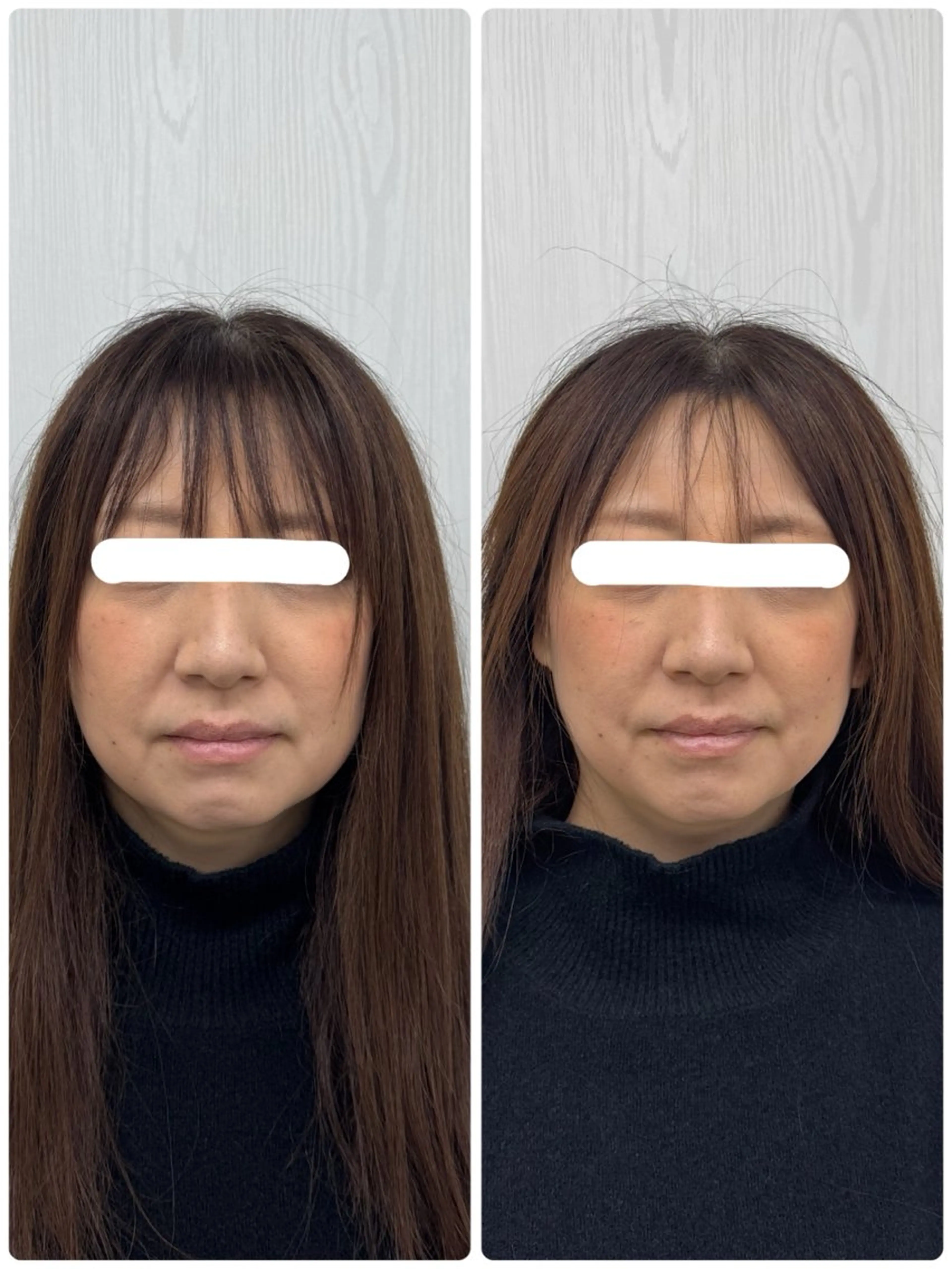 エステ リラク 美容鍼×小顔矯正 ×美容整体　浜川泰仁のエステ・リラクイメージ