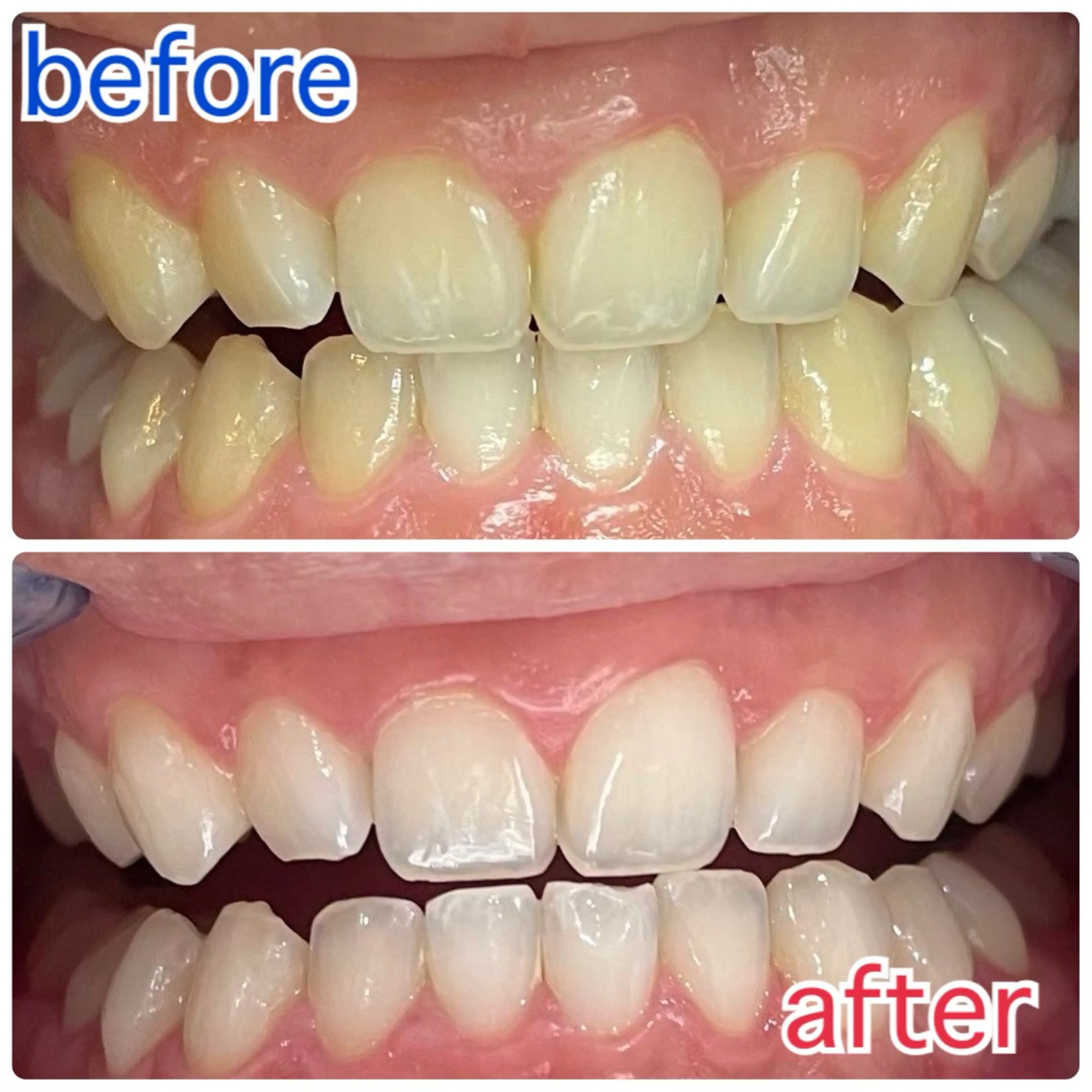 サクッとホワイト五反田店所属・セルフホワイトニング 五反田のその他イメージ