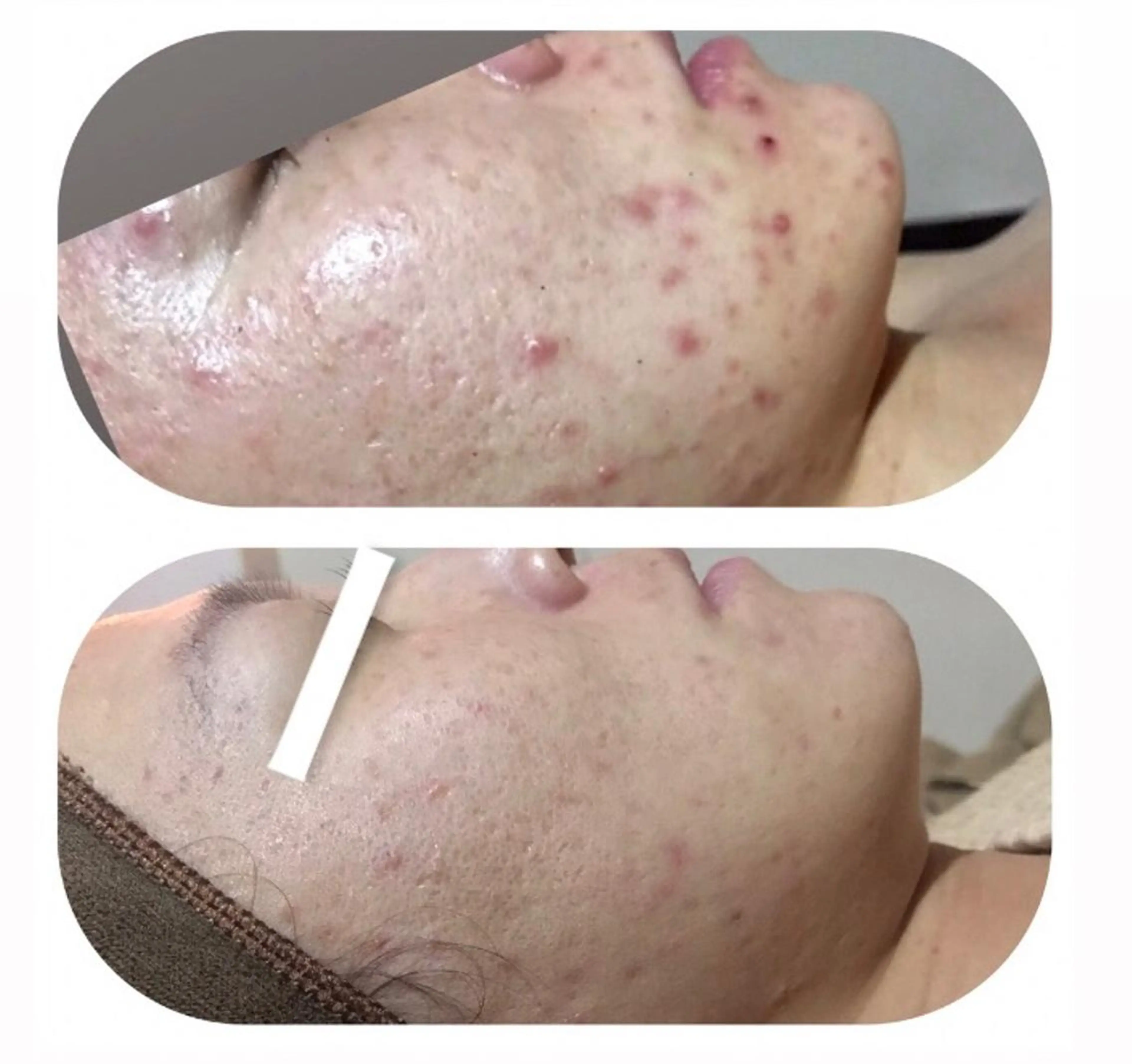 【足圧】鬼👹リンパ 身体整うサロンのエステ・リラクイメージ