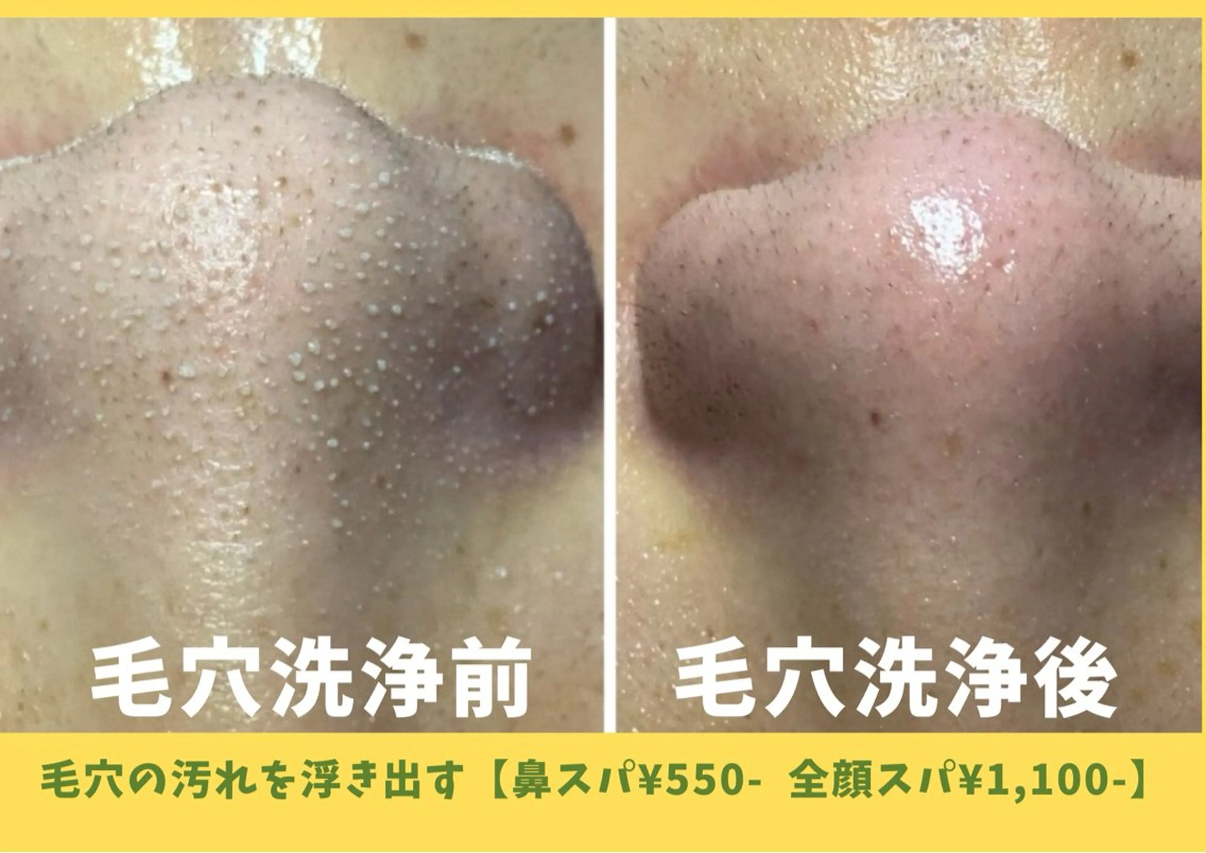 毛穴フェイシャル エステ専門店BBのエステ・リラクイメージ