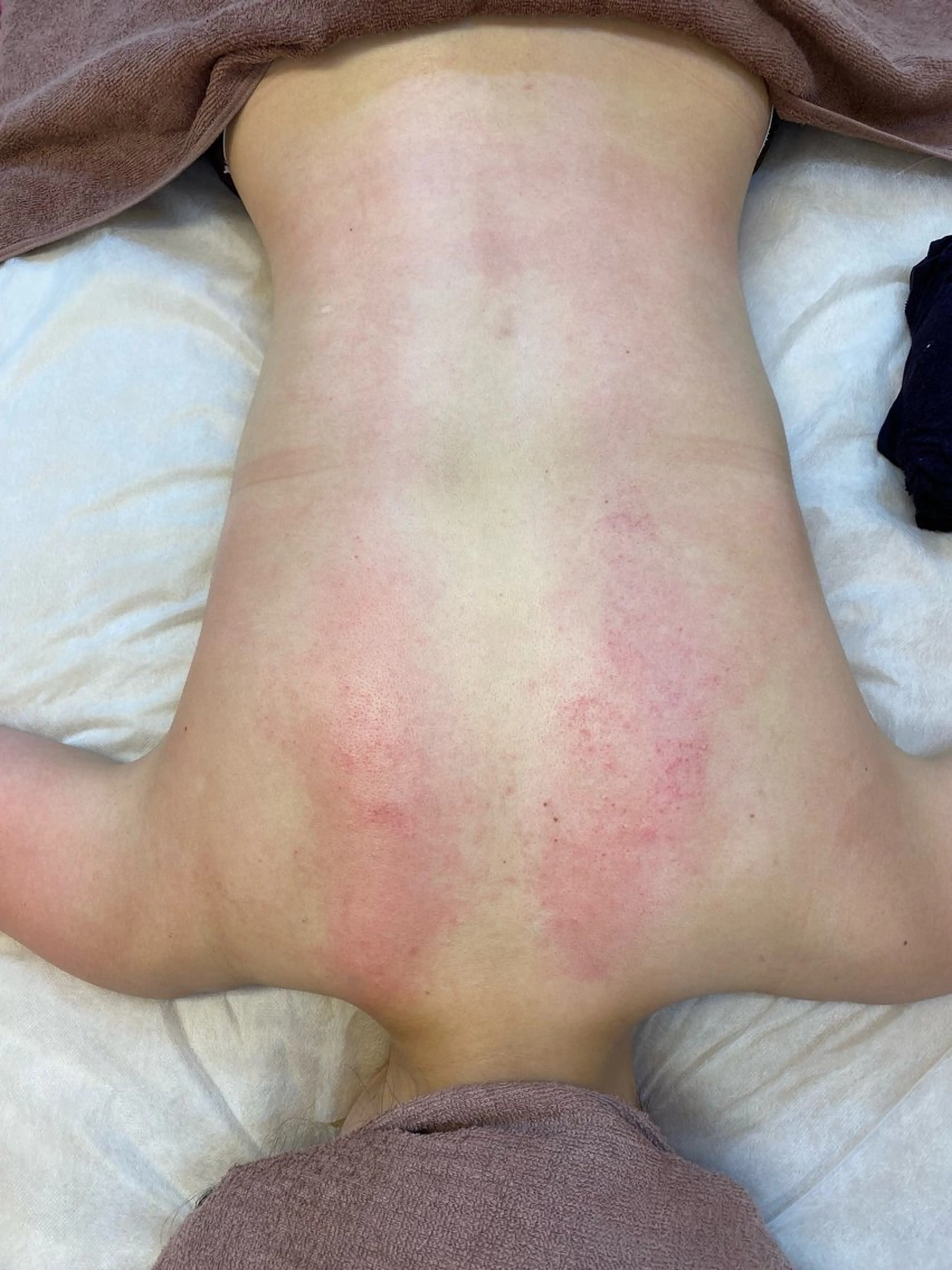 エステ リラク あおやまびじん 西新井店 | 小野のエステ・リラクイメージ