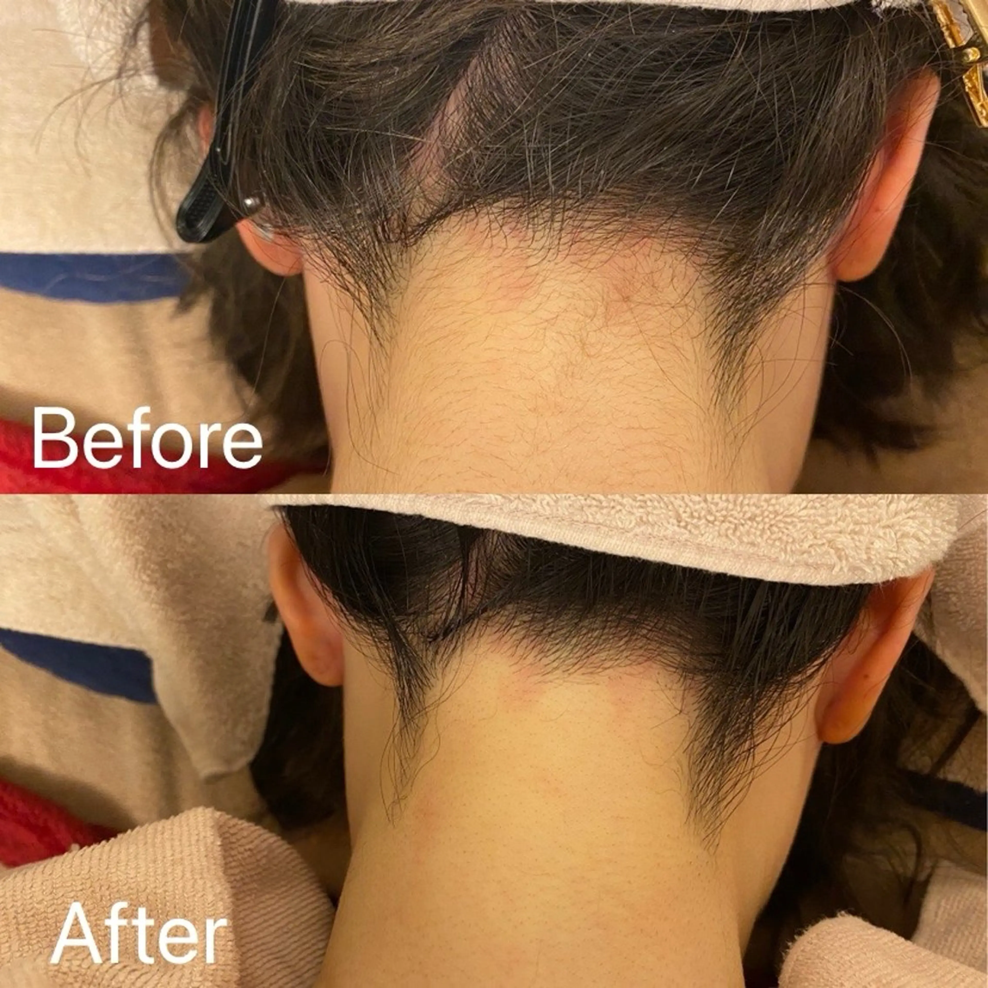 脱毛 Dione自由が丘 山下有香子のエステ・リラクイメージ