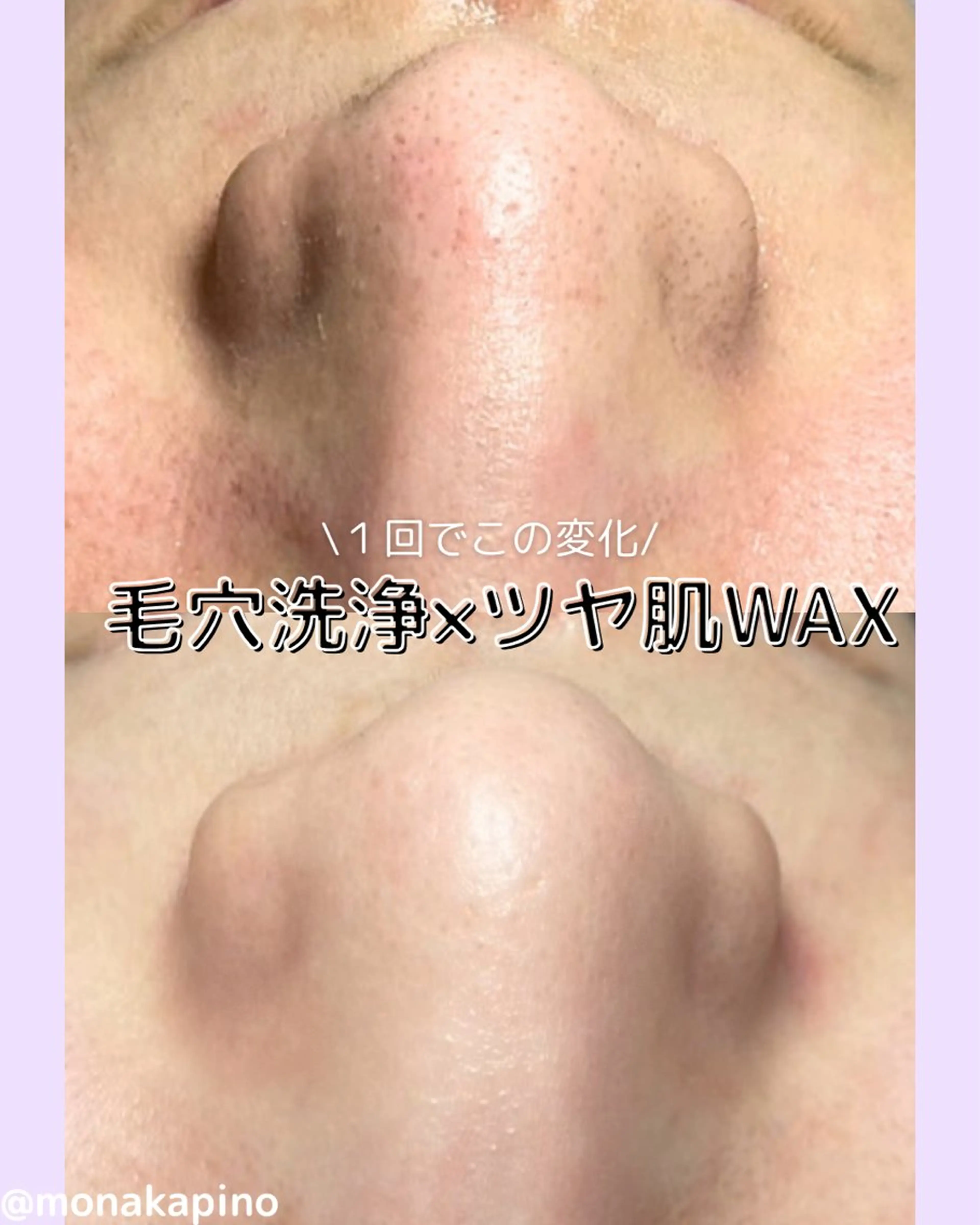 エステ Diailes 💎ななのエステ・リラクイメージ