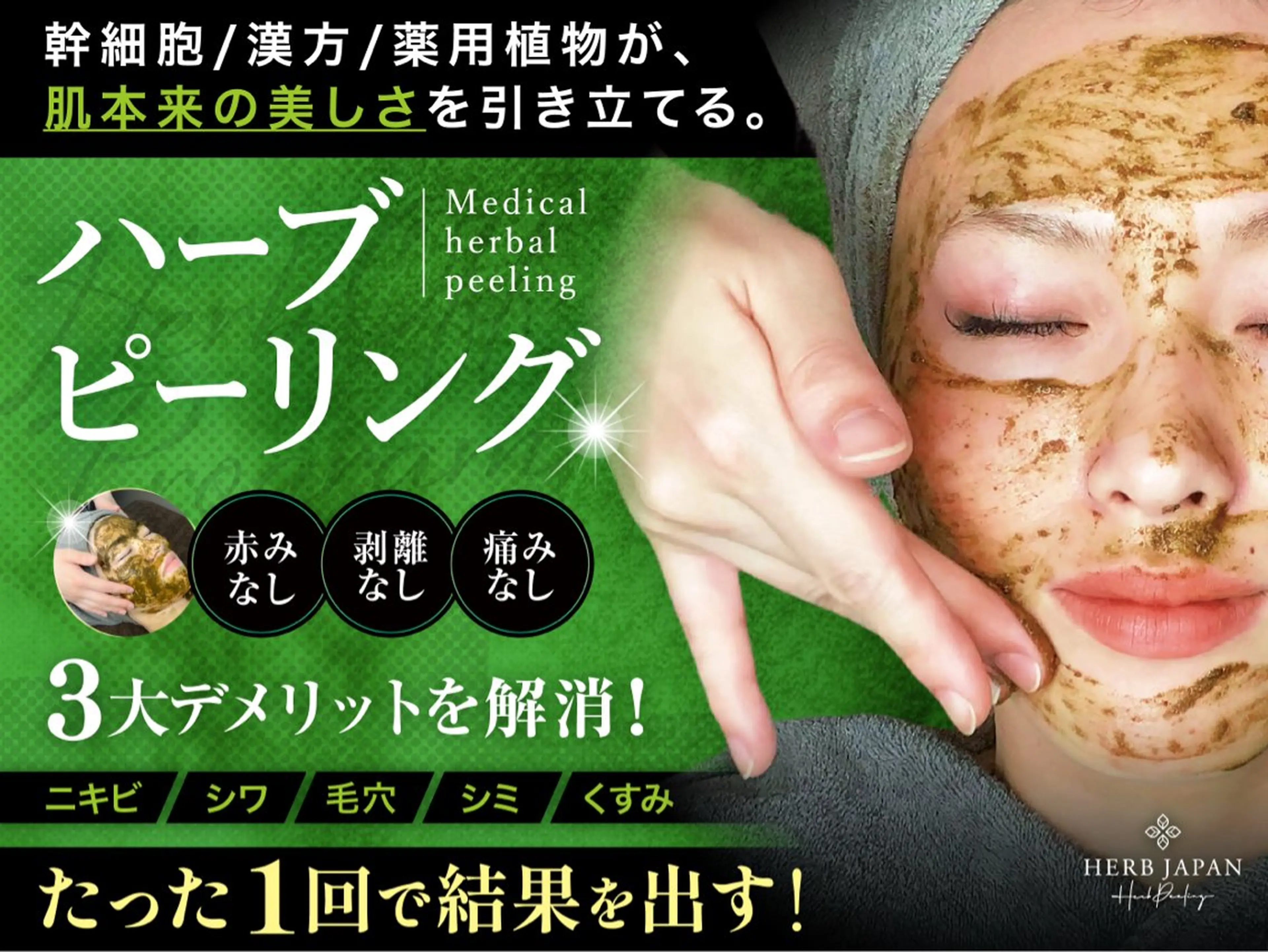 全顔脱毛×新世代国産ハーブピーリング🌸🌸の写真