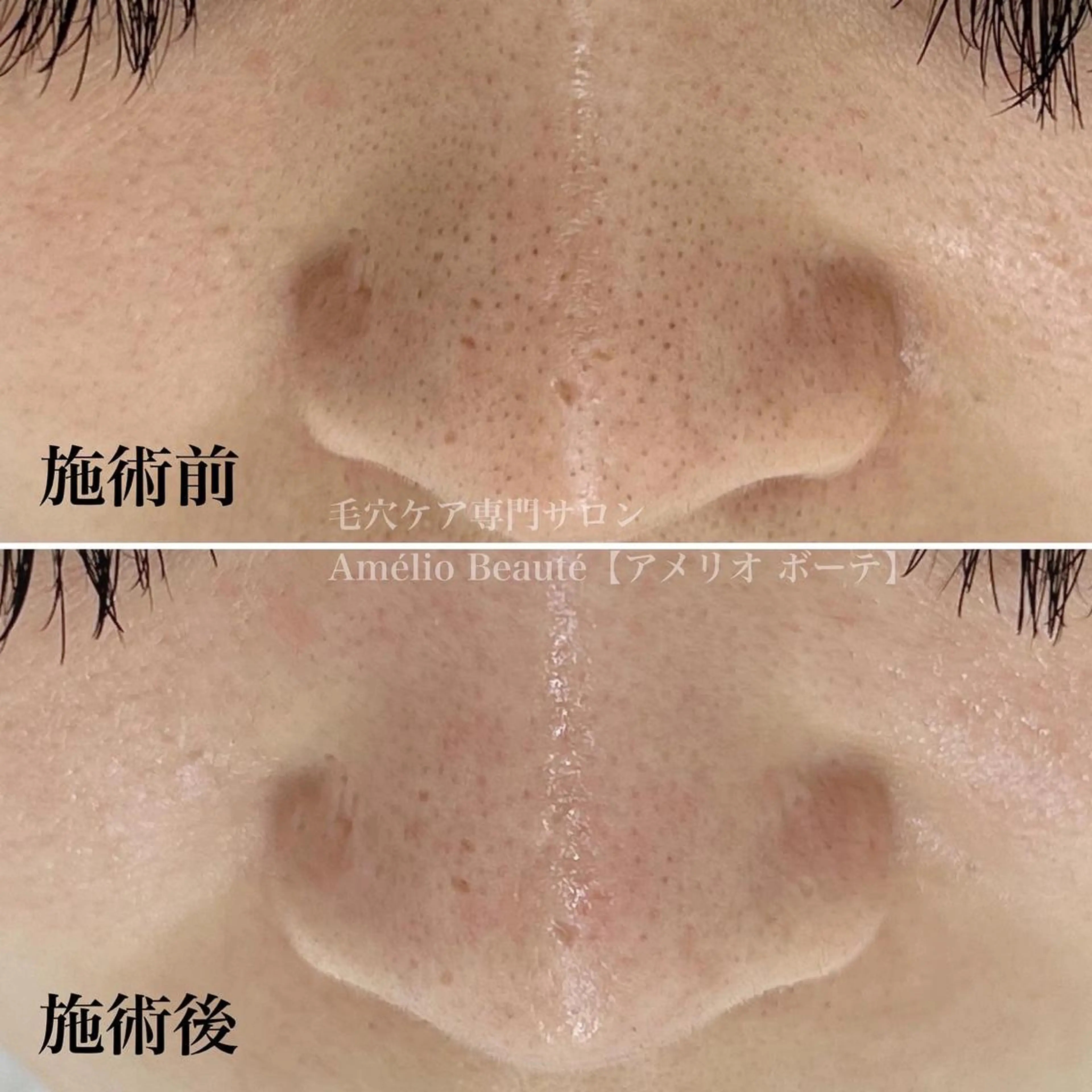 毛穴ケア専門サロン アメリオボーテのその他イメージ