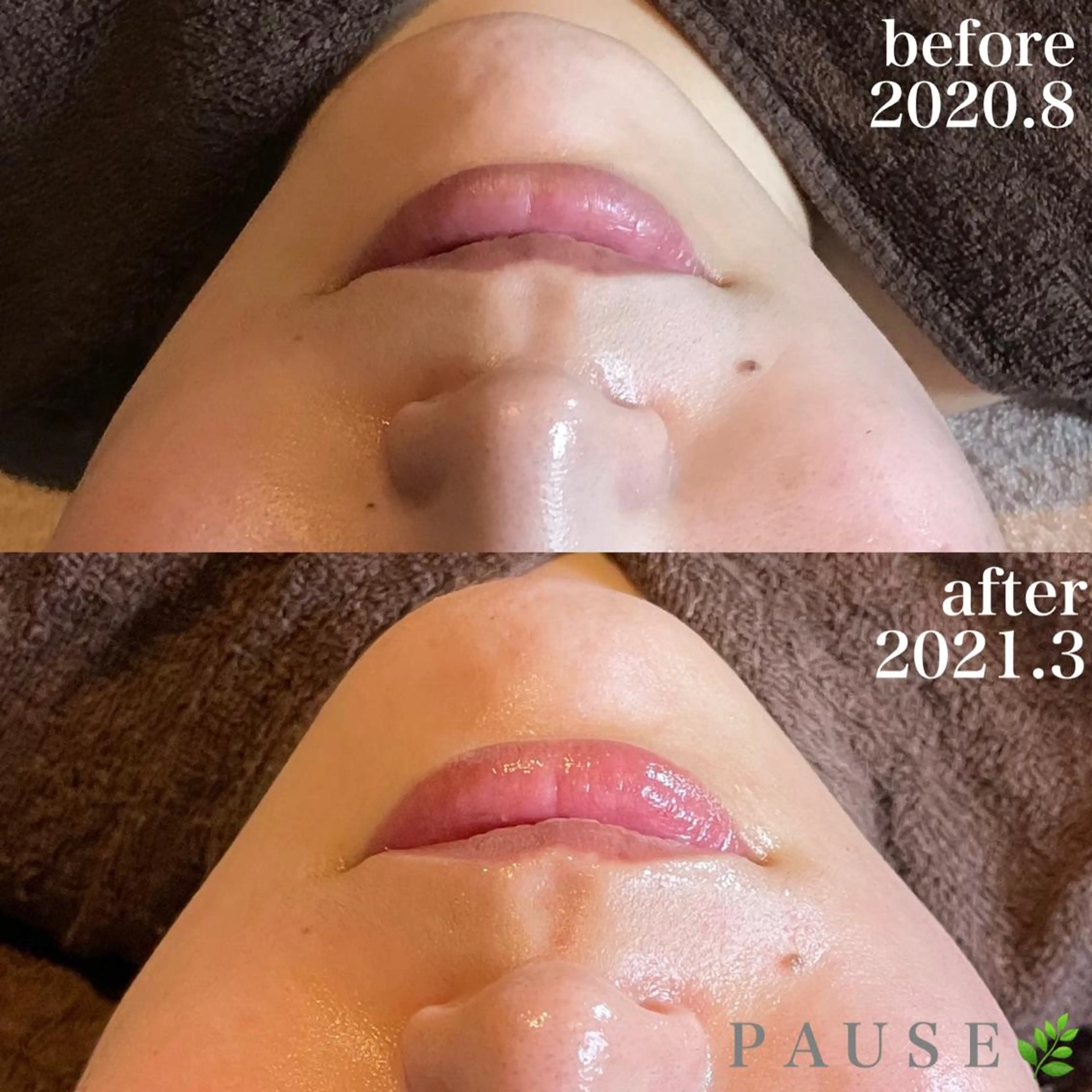 エステ 浜野 恵美のエステ・リラクイメージ