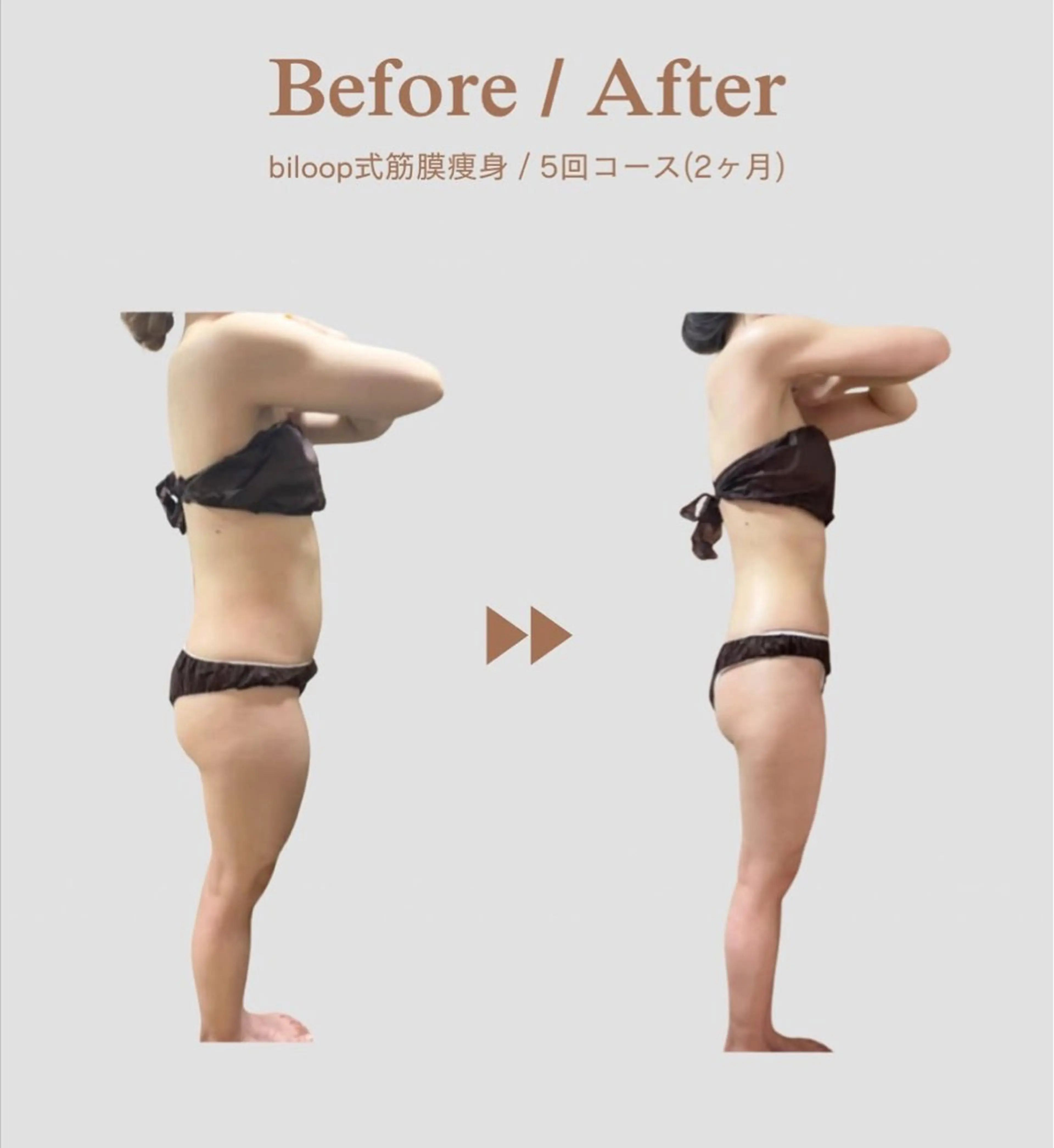 エステ リラク 《本気痩せ×疲労改善 》  BILOOPのエステ・リラクイメージ