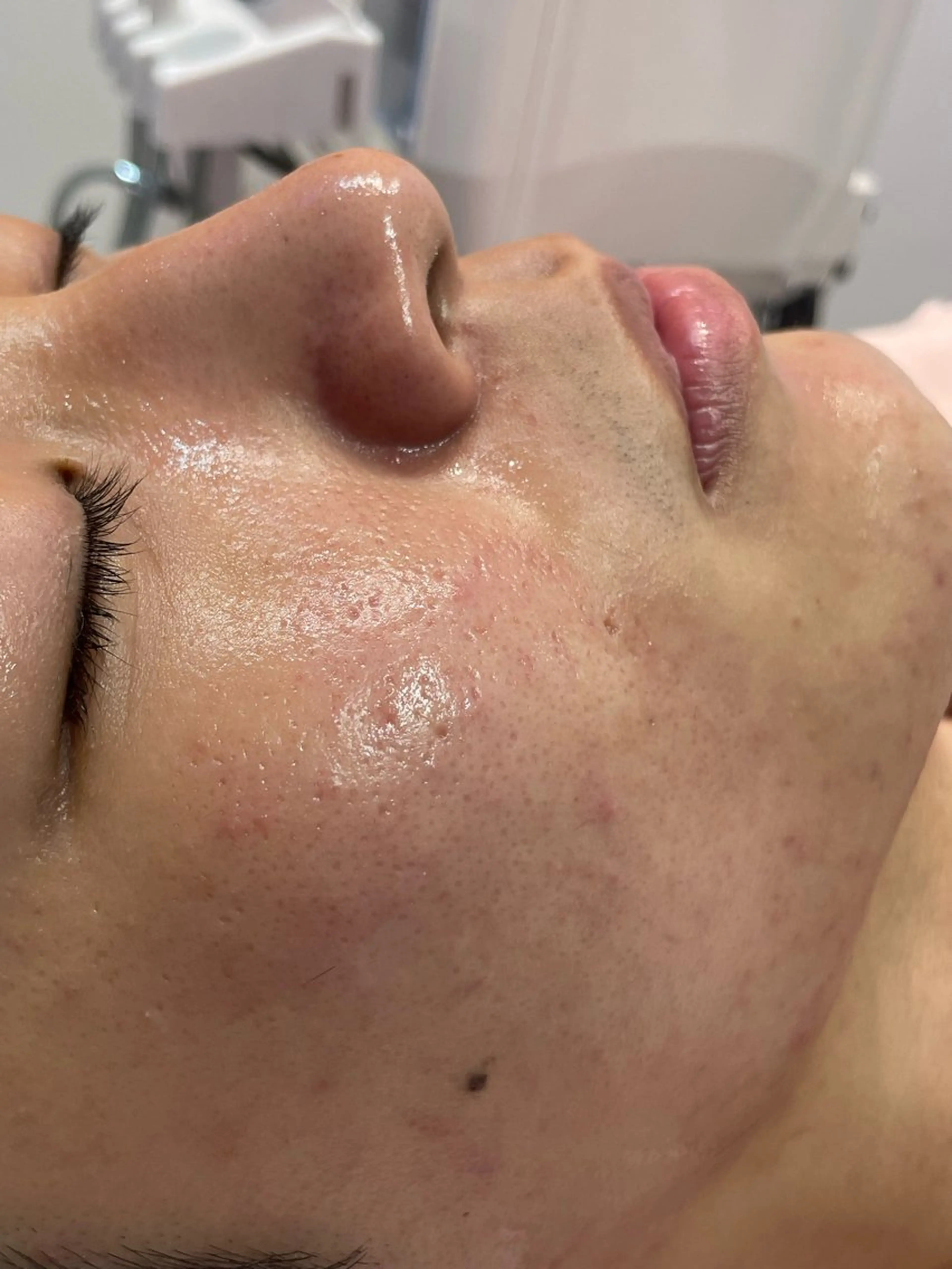 メンズ 戸田 麗のその他イメージ