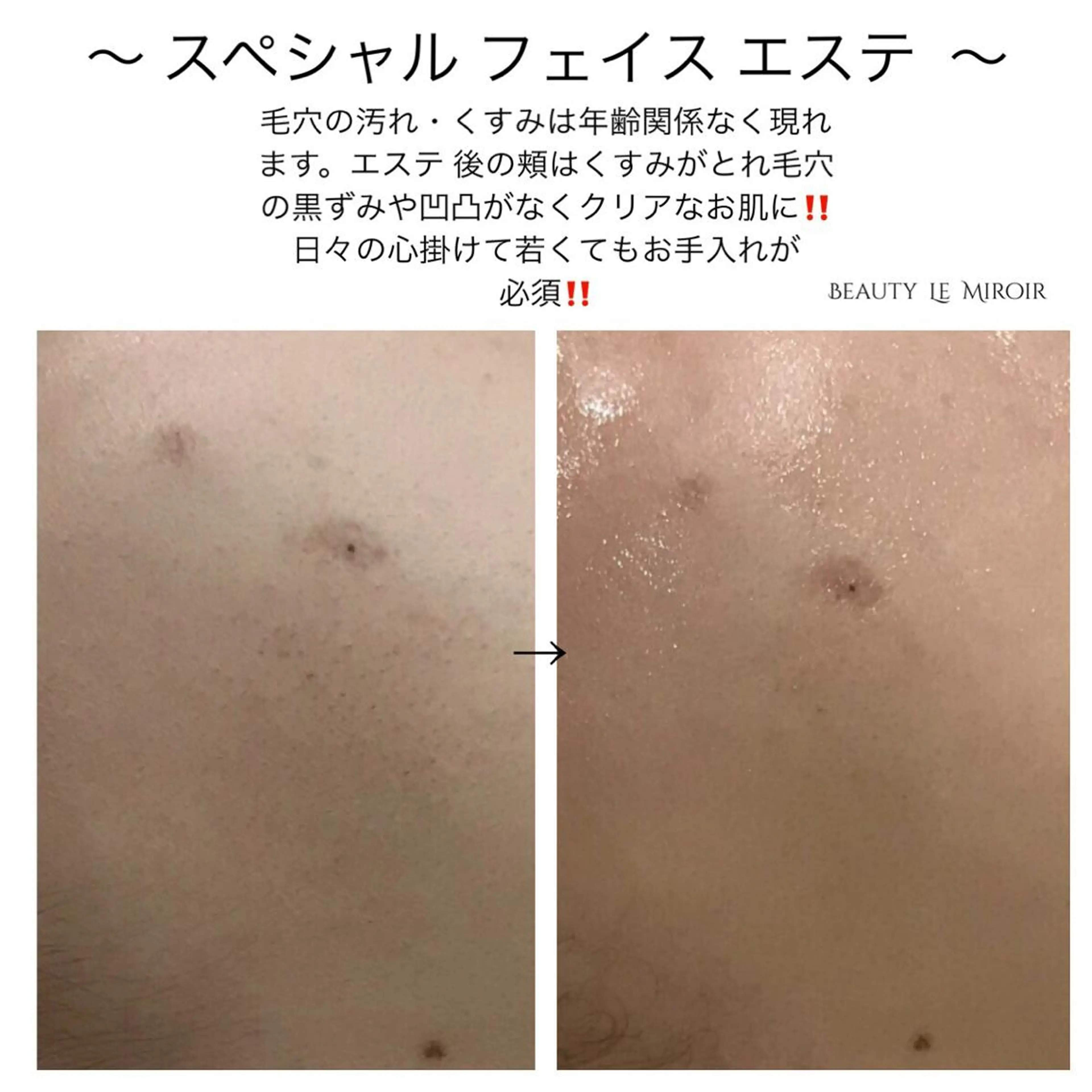 マツエク・マツパ ビューティー ミロワールのエステ・リラクイメージ