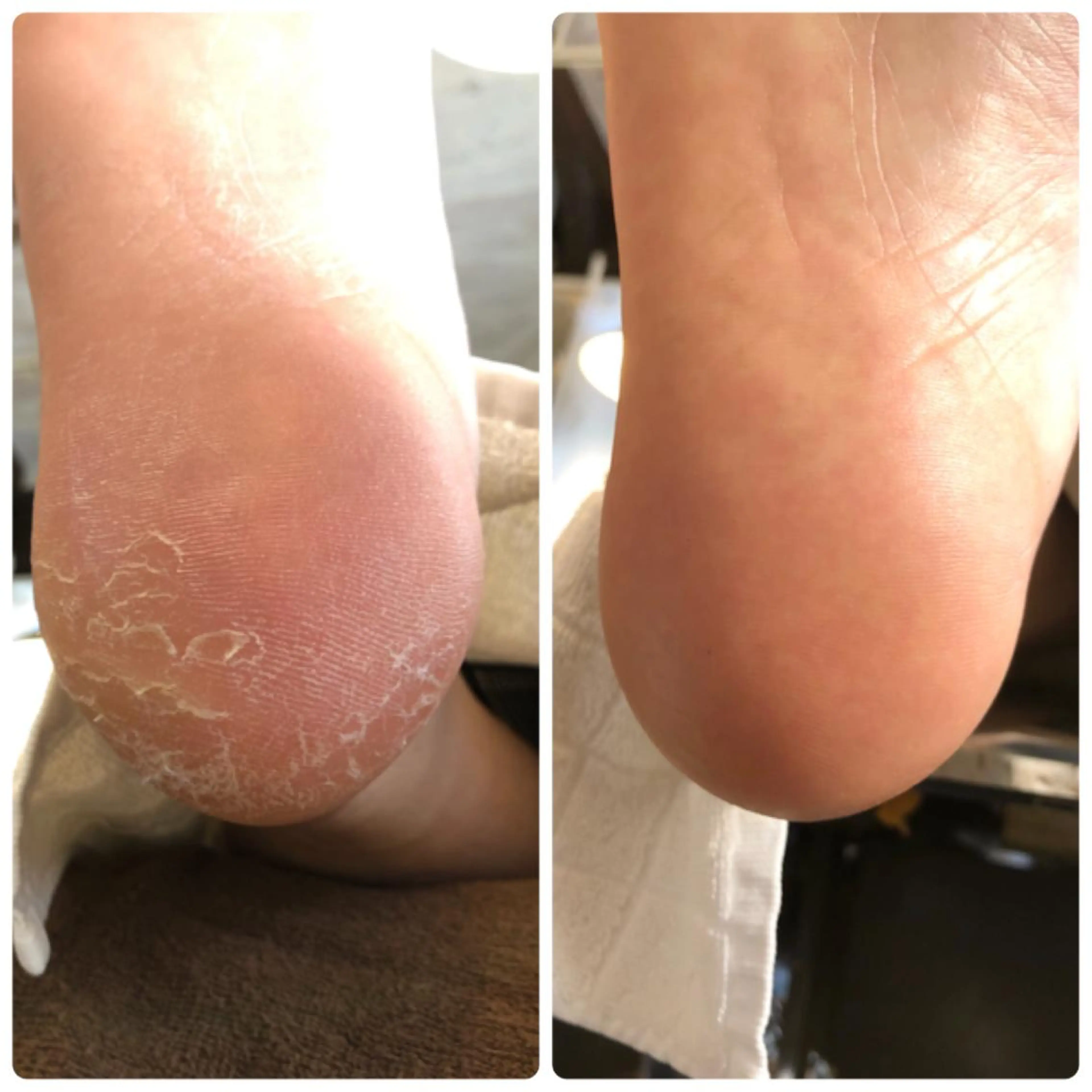 ネイル その他(ネイル) &nudgenail 本多のネイルデザイン