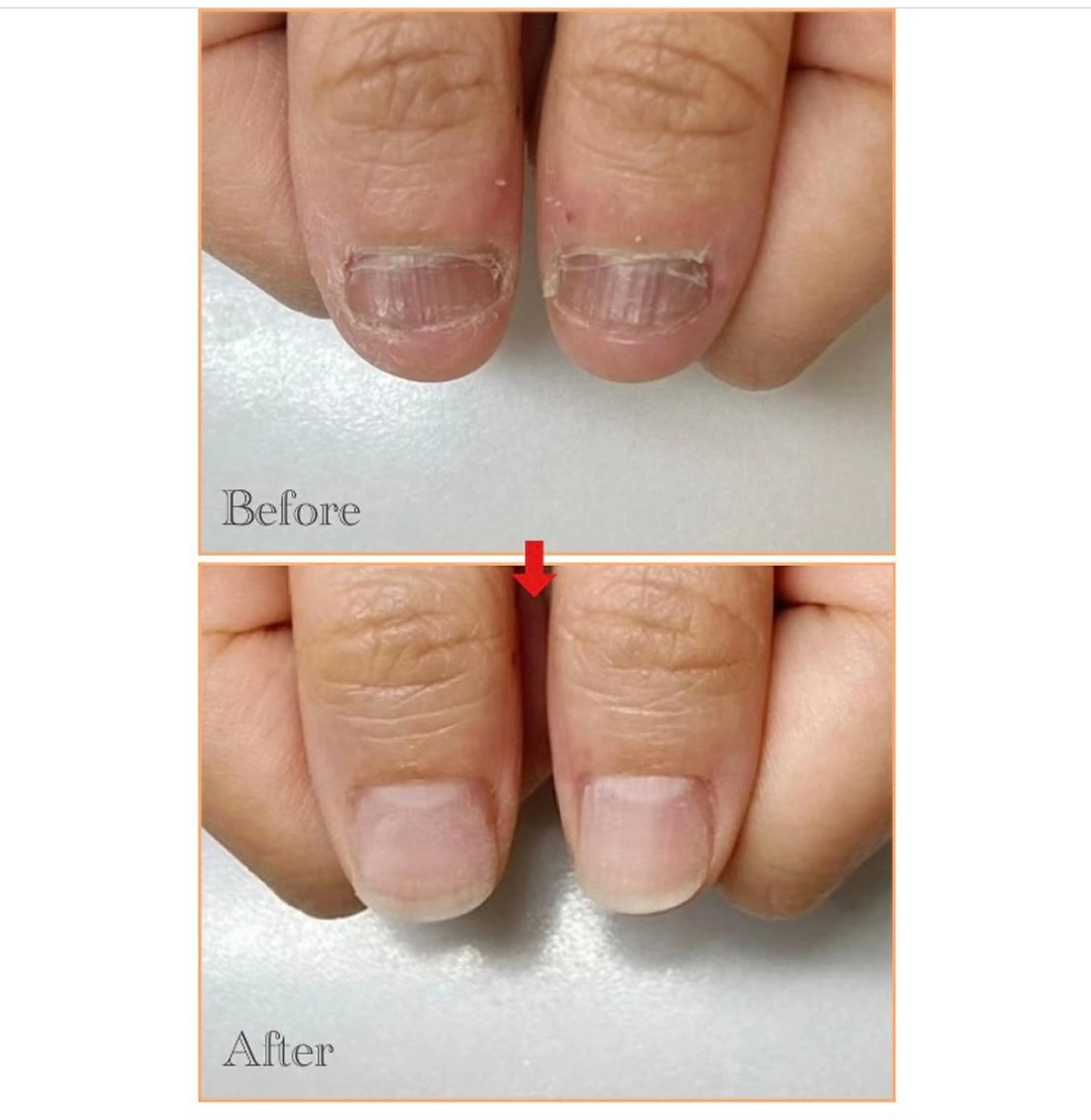 ネイル ネイルサロン アリュームのネイルデザイン