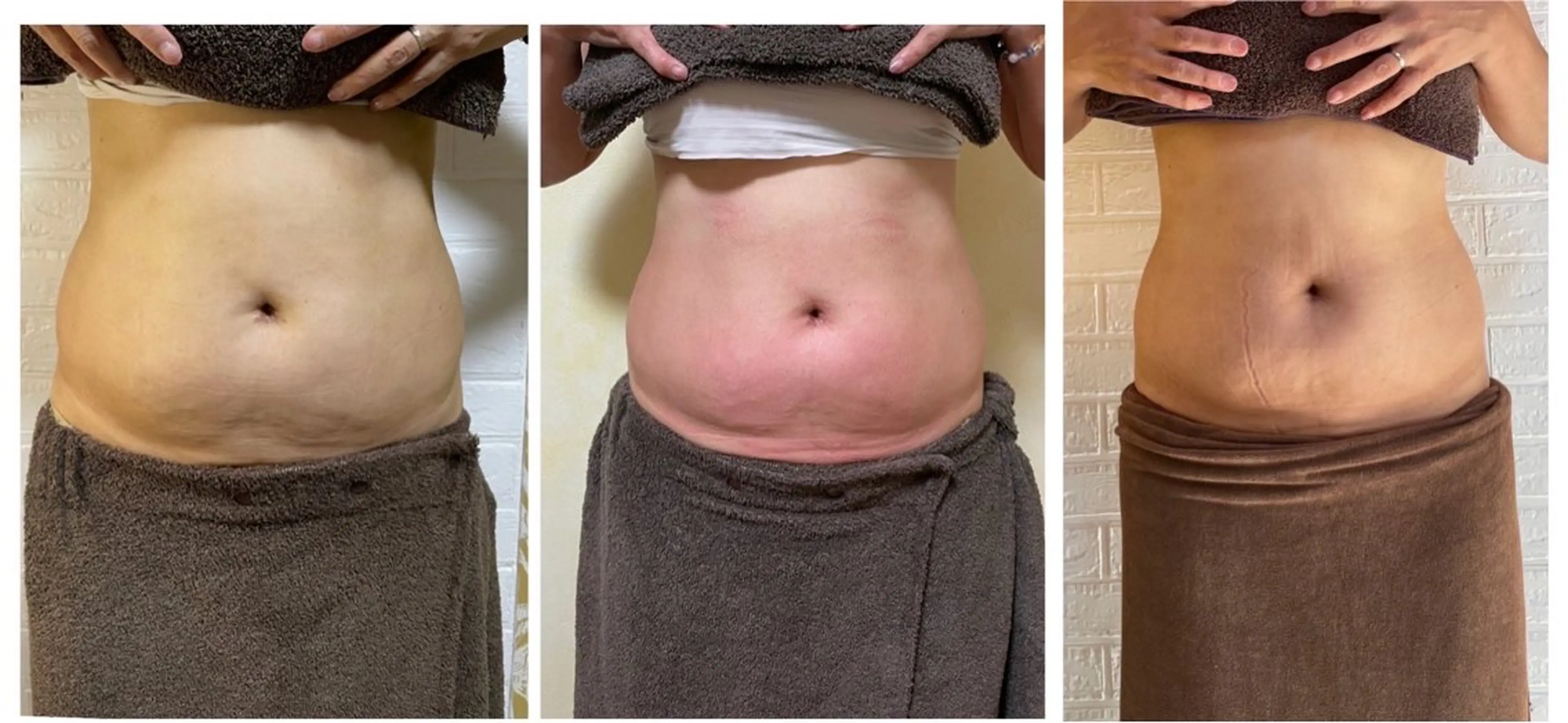 リラク プライベート美容脱毛 JR久宝寺徒歩1分のエステ・リラクイメージ