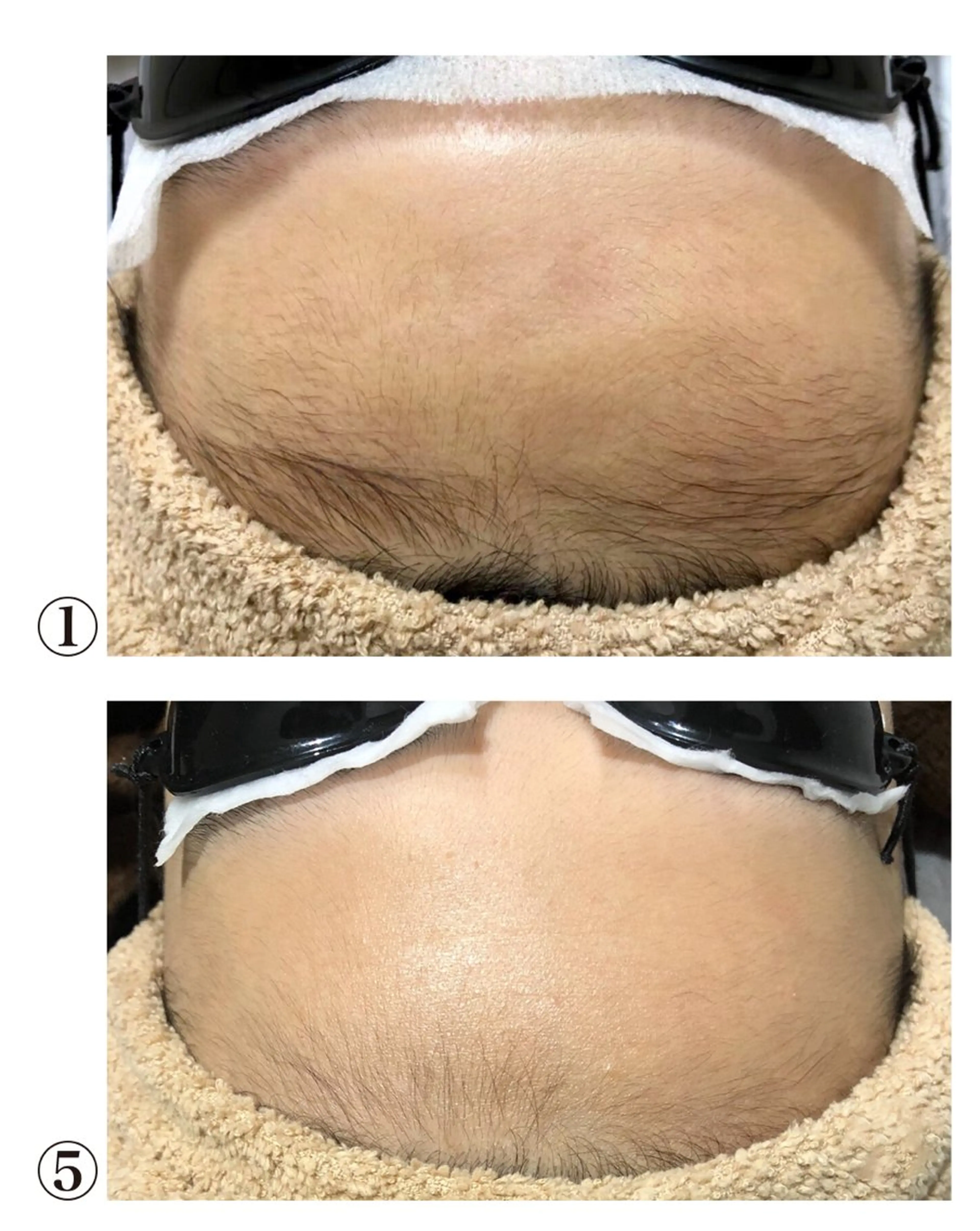 脱毛 ReBORN 脱毛サロン所属・ReBORN 脱毛サロンのエステ・リラクイメージ