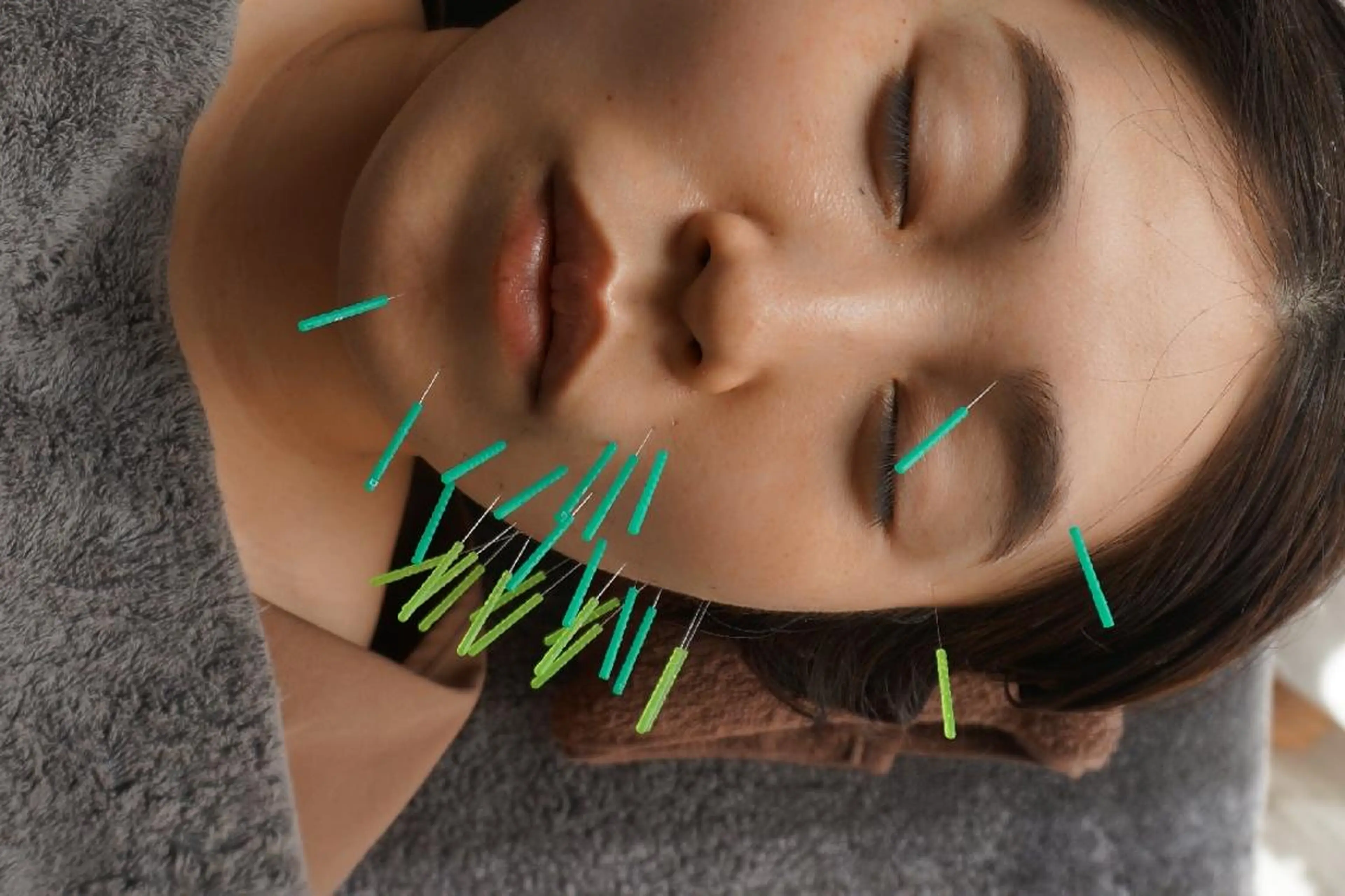 エステ リラク 即効⚡小顔美容鍼🪡 むくみたるみ脂肪解消のエステ・リラクイメージ