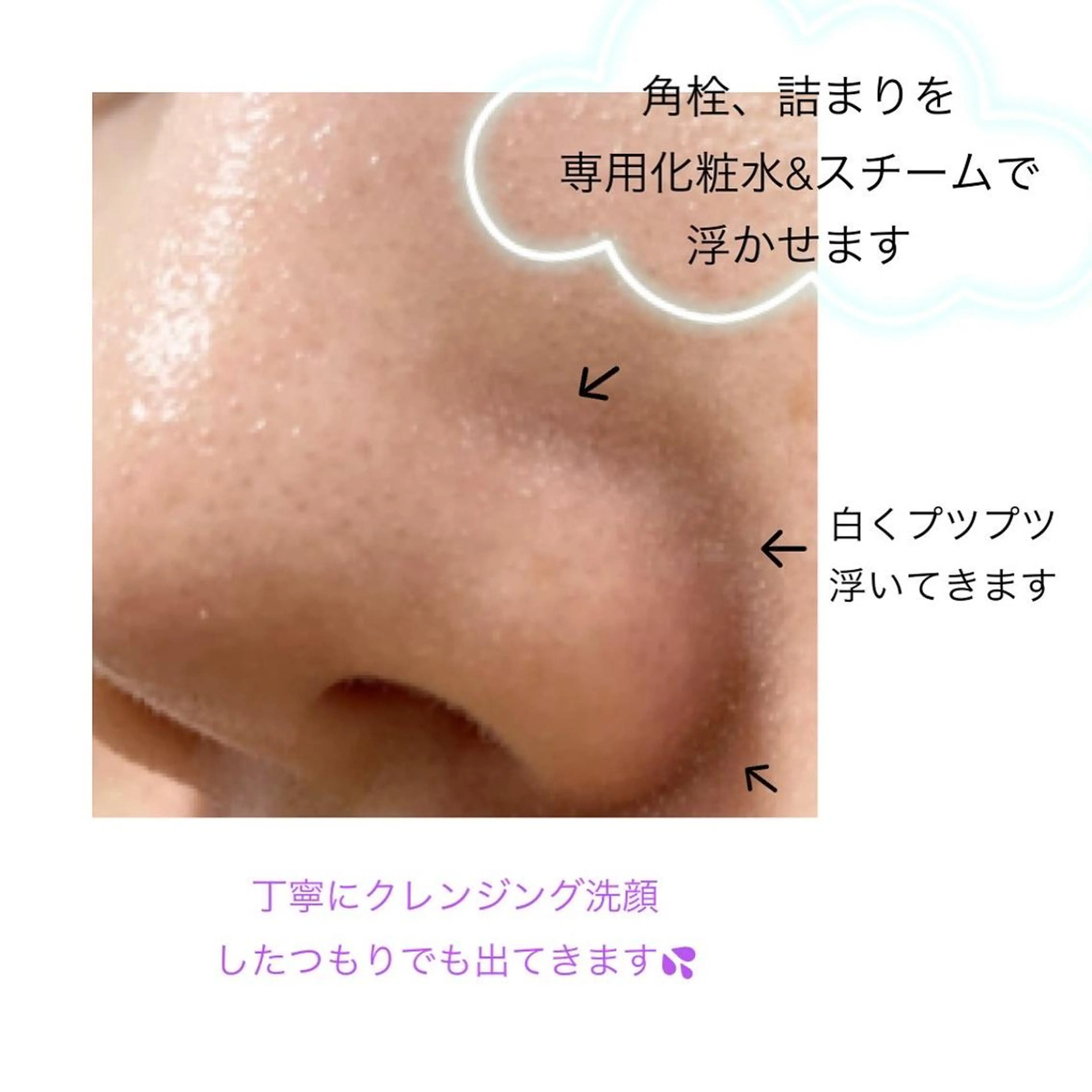 エステ ニキビ/敏感肌/乾燥 Lilyauraのエステ・リラクイメージ