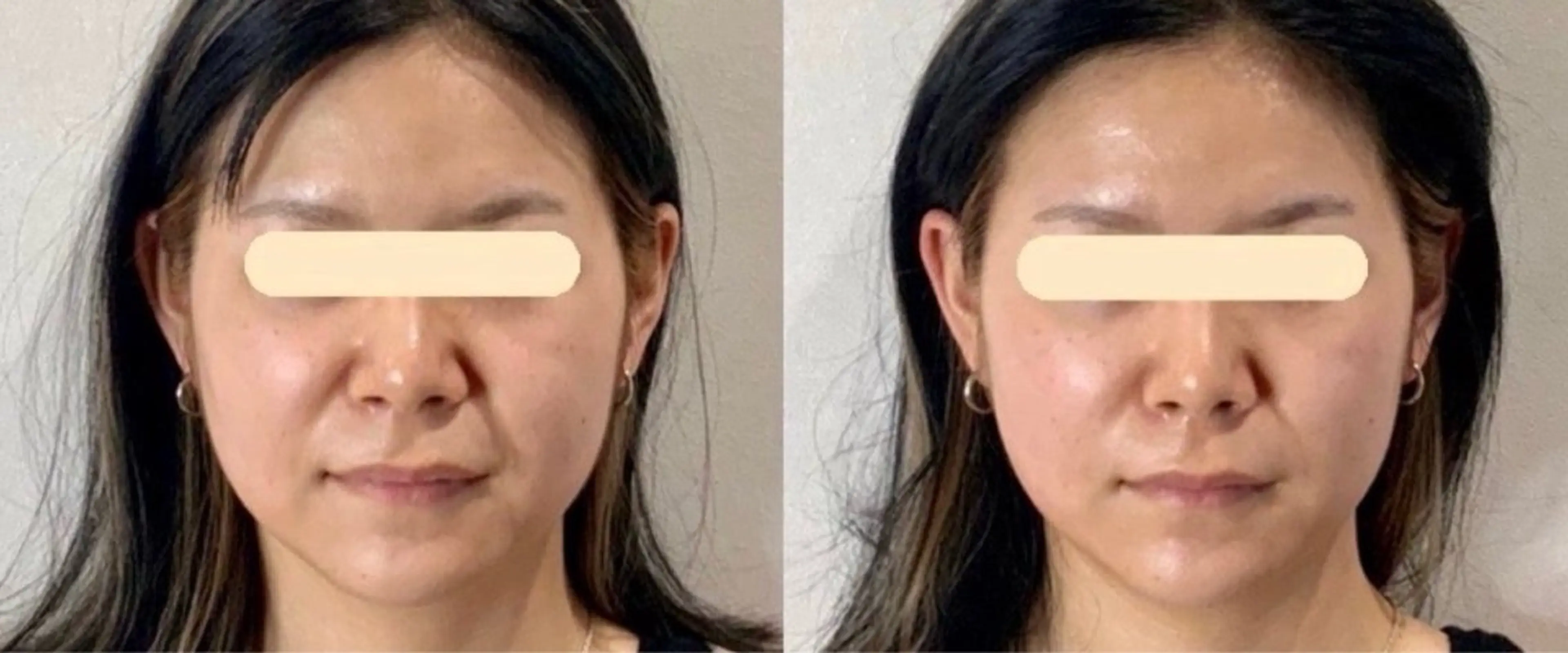 マツエク・マツパ エステ リラク 愛維美水光美肌専門店 メンズレディースokのエステ・リラクイメージ