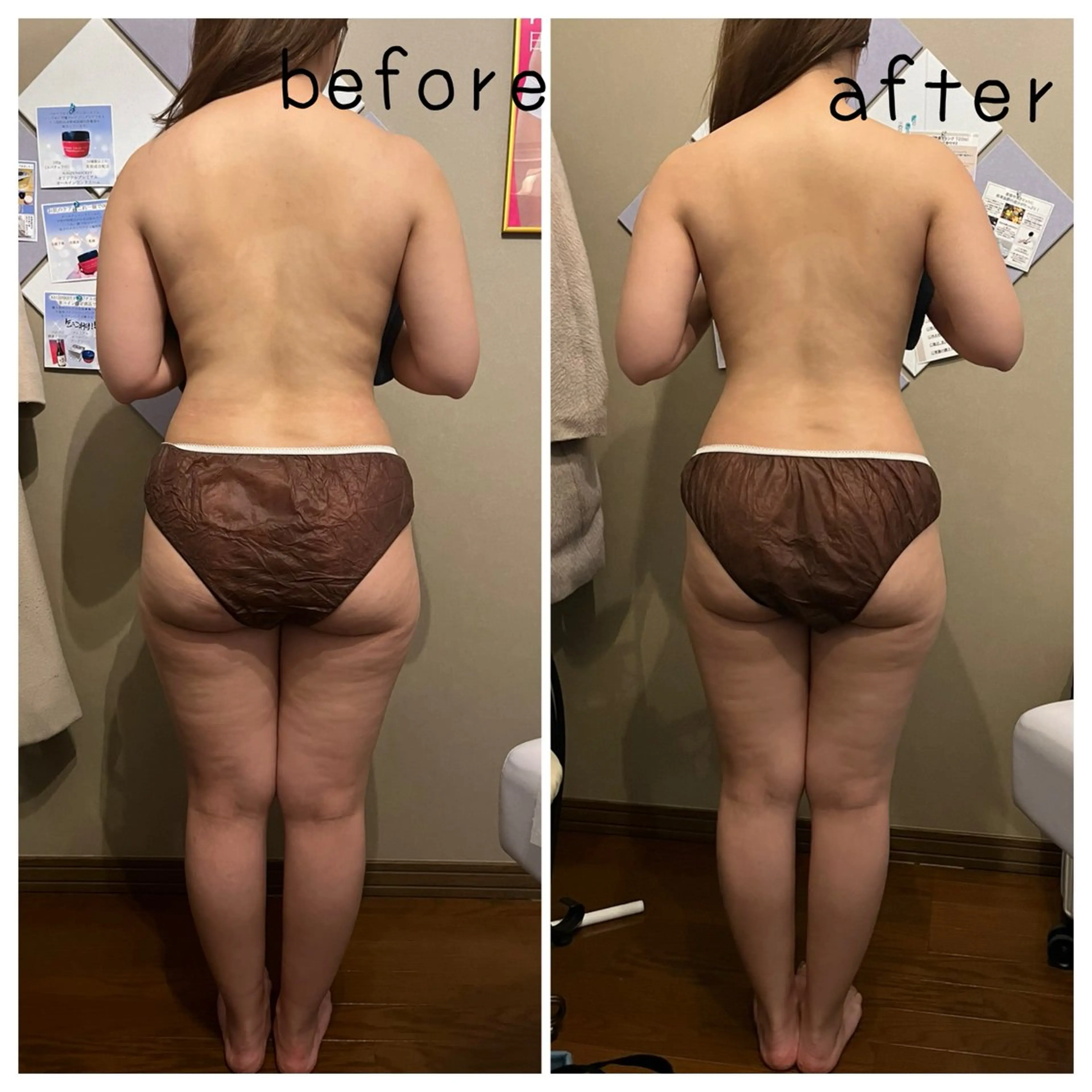 80分オールハンドオイルトリートメントの写真