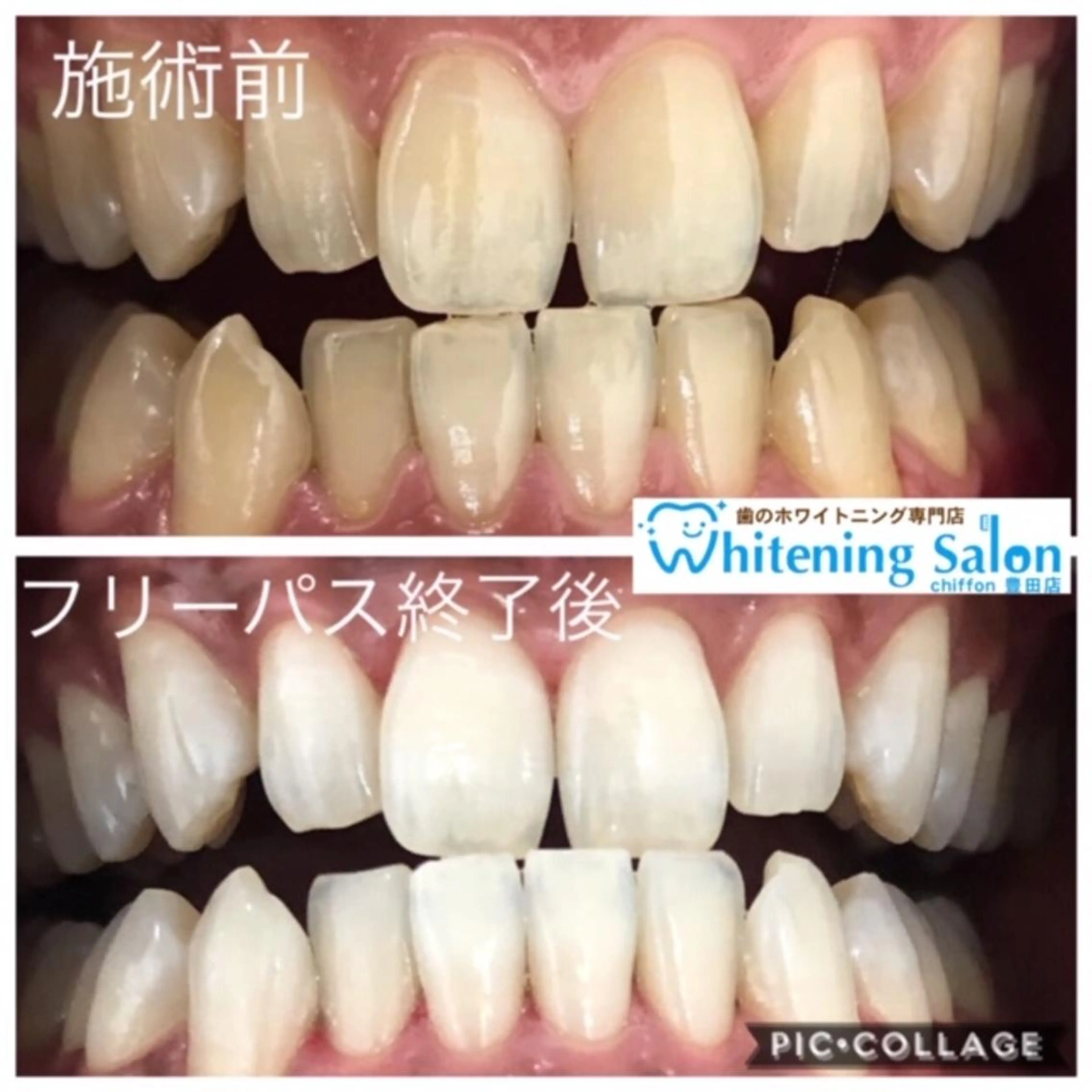 歯科レベルの白さ💎 ✨ホワイトニング豊田のエステ・リラクイメージ