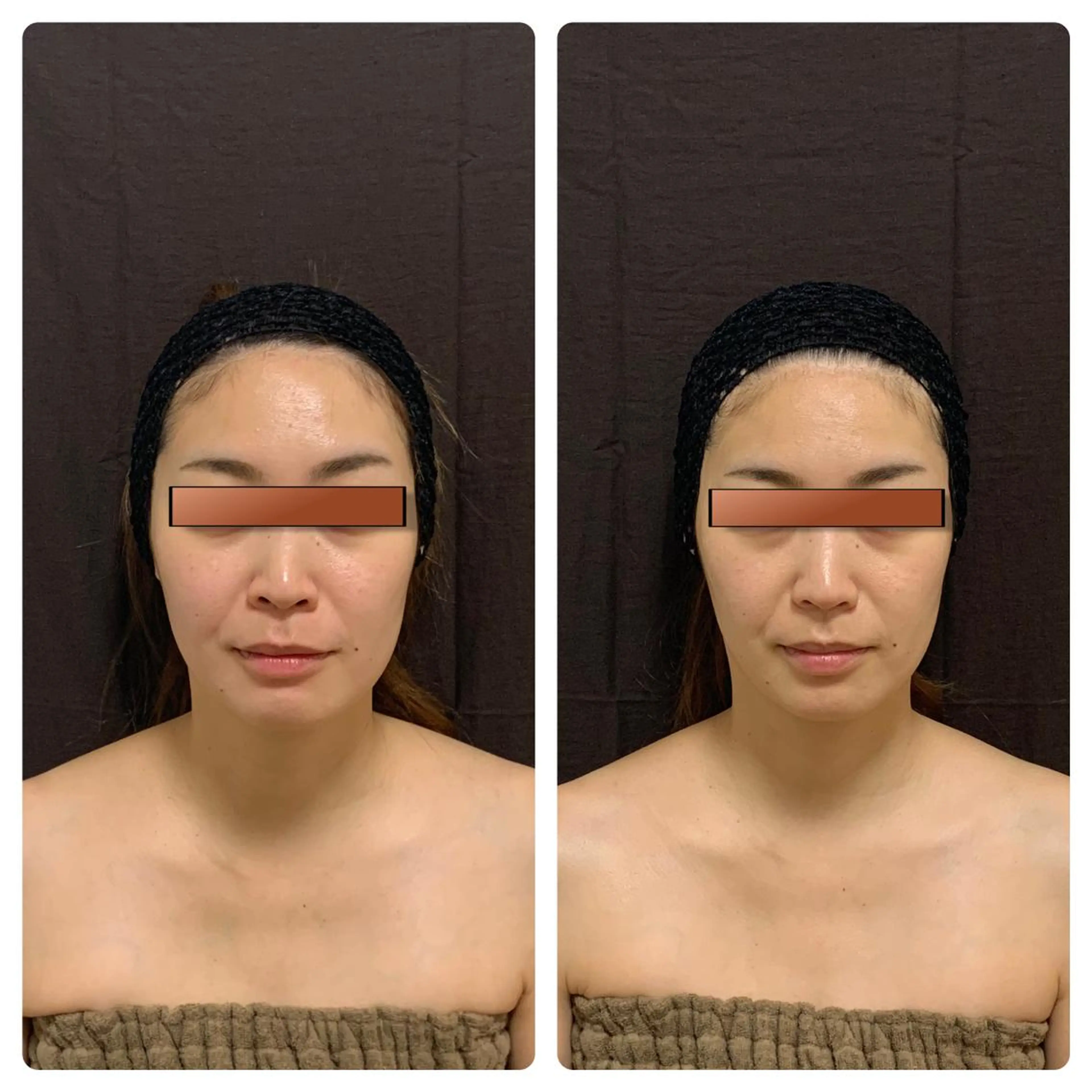 あるる所属・韓国式小顔矯正 担当ゆいのエステ・リラクイメージ