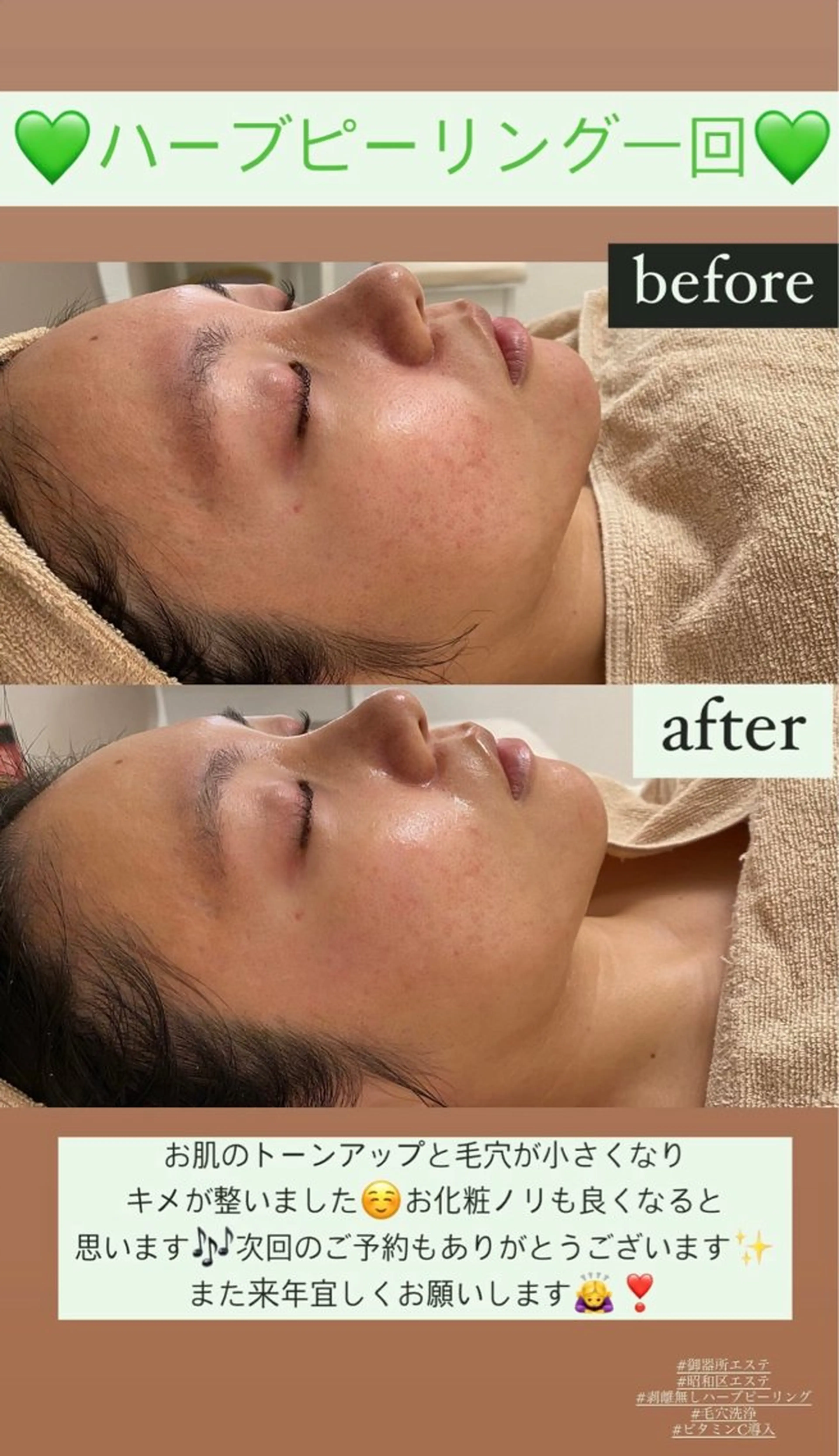 メンズ エステ Salon de Lino 御器所のエステ・リラクイメージ