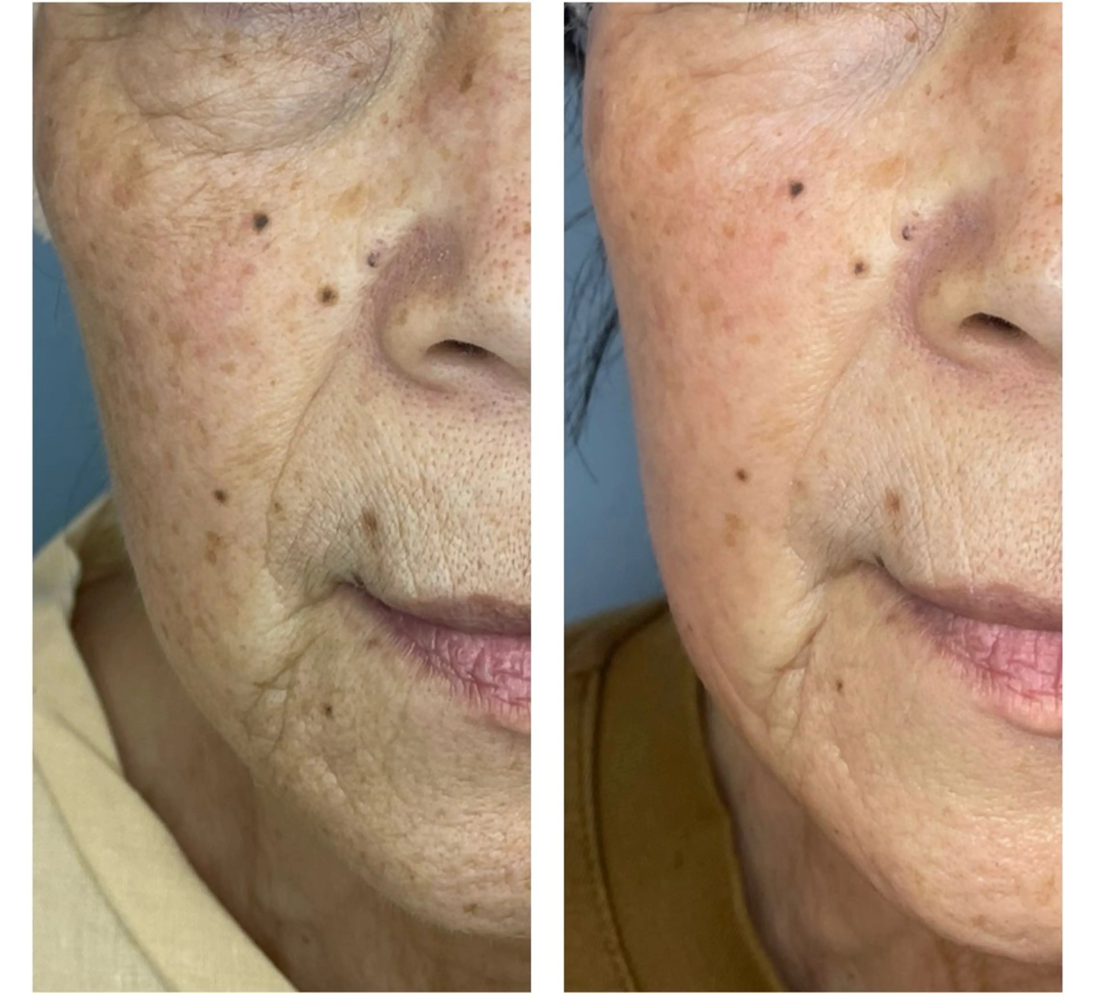 エステ moe beauty salon所属・moe sayuriのエステ・リラクイメージ