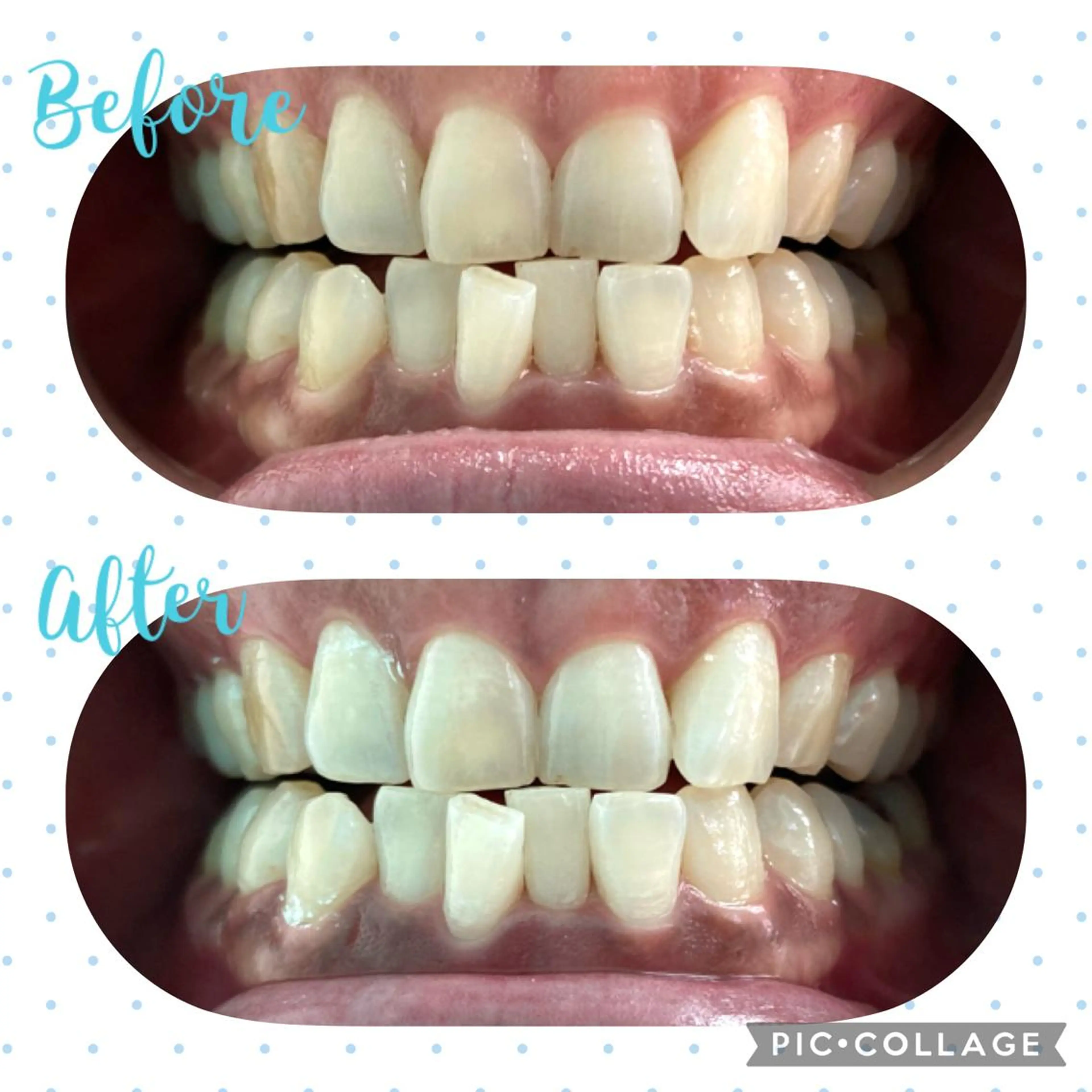 セルフホワイトニングCOCOSHIRO所属・セルフホワイトニング COCOSHIROのエステ・リラクイメージ