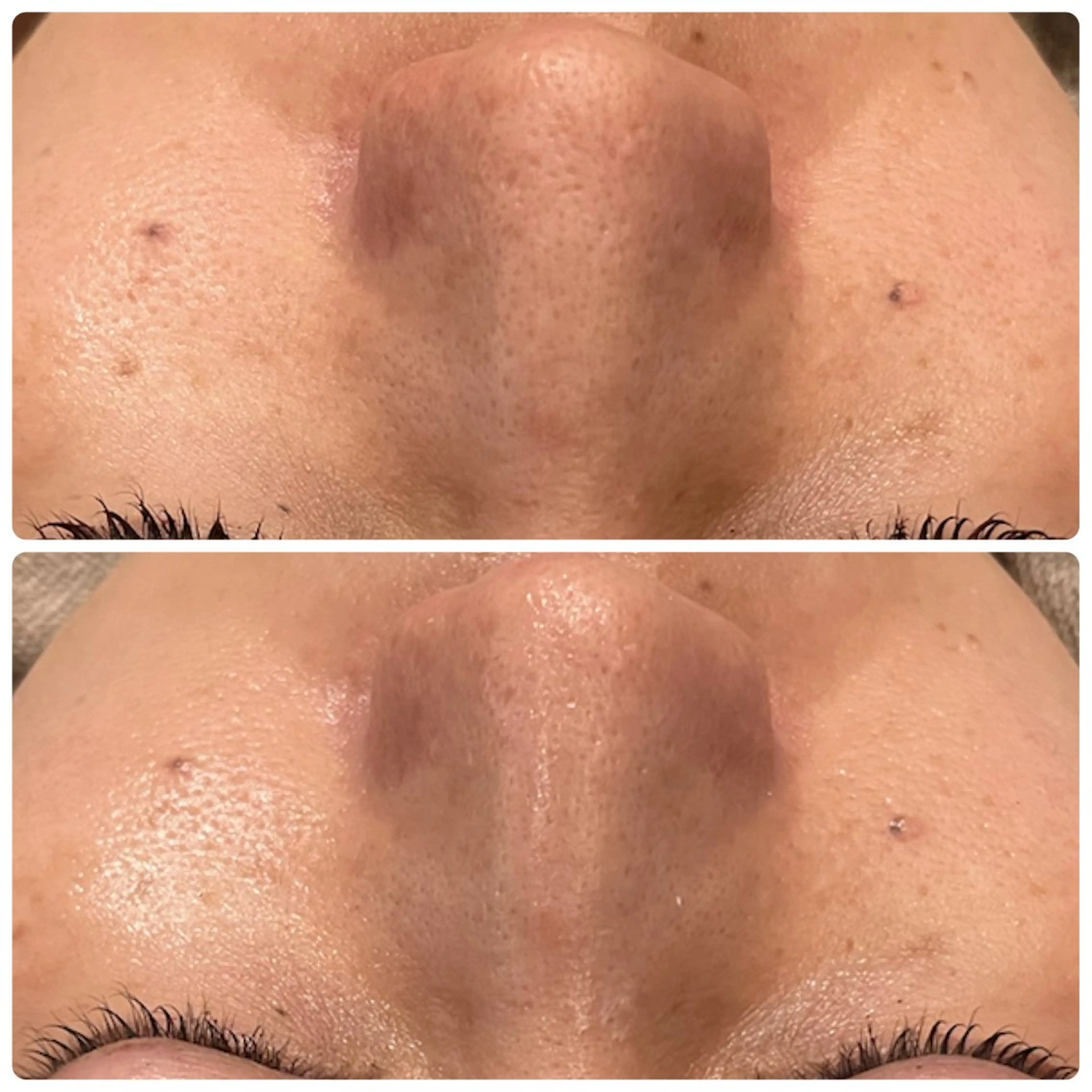 その他 yellow.所属・yellow💛【 脱毛&フェイシャル】のエステ・リラクイメージ