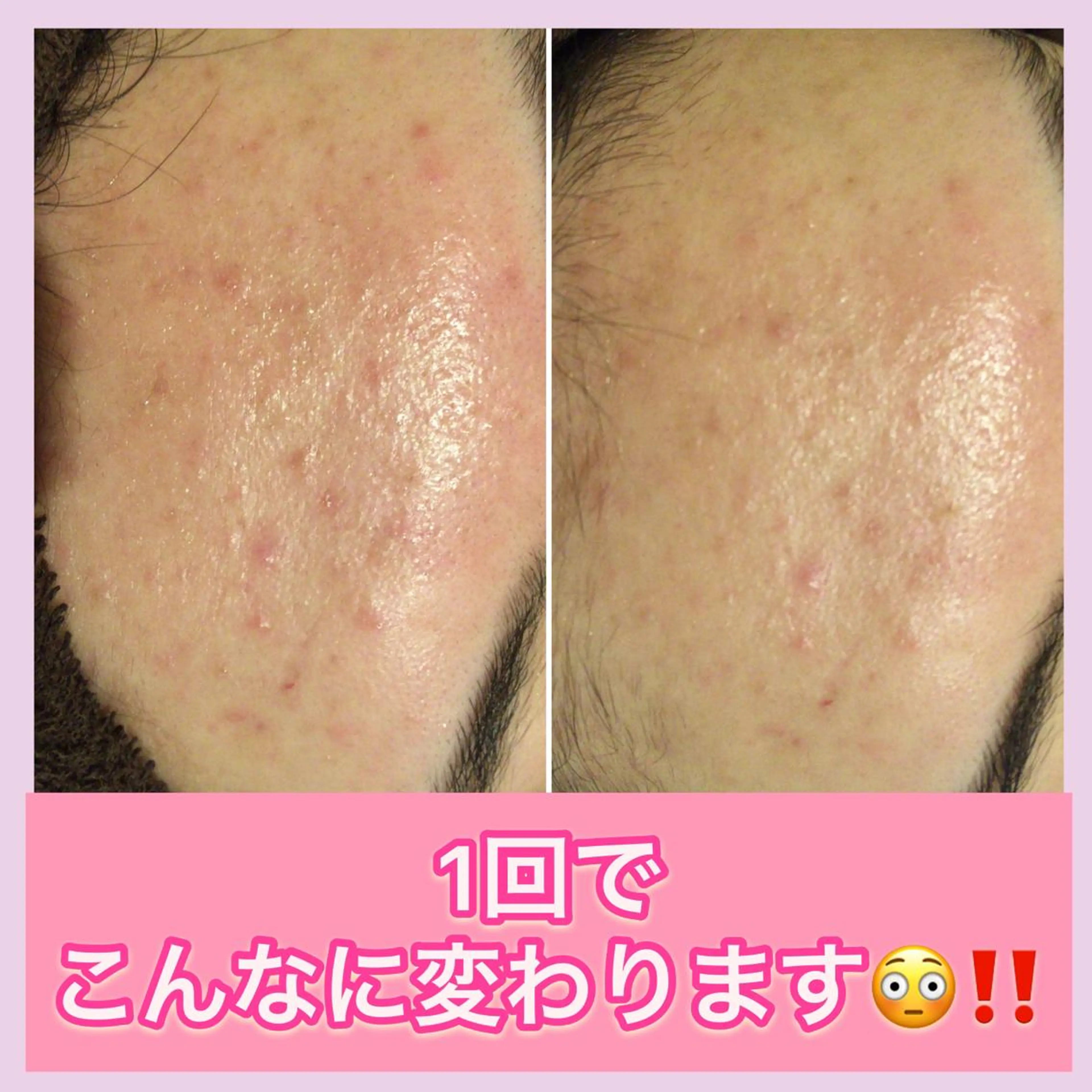 ミディアム カラー パーマ ヘアアレンジ メンズ キッズ ネイル マツエク・マツパ ニキビ・肌質改善専門 ♡人生が変わるサロンのエステ・リラクイメージ