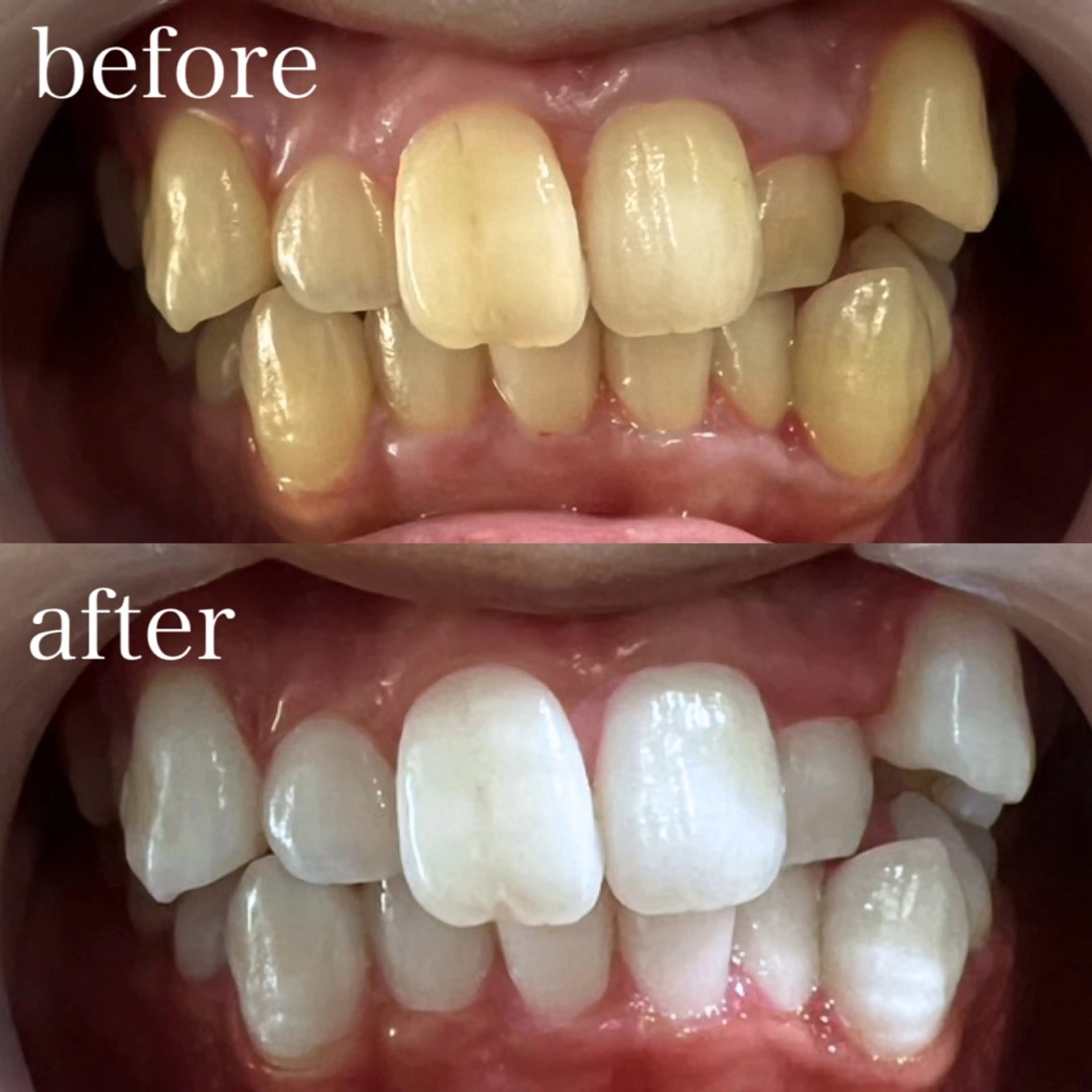 その他 ホワイトニング×肌質 改善~elエル~のその他イメージ